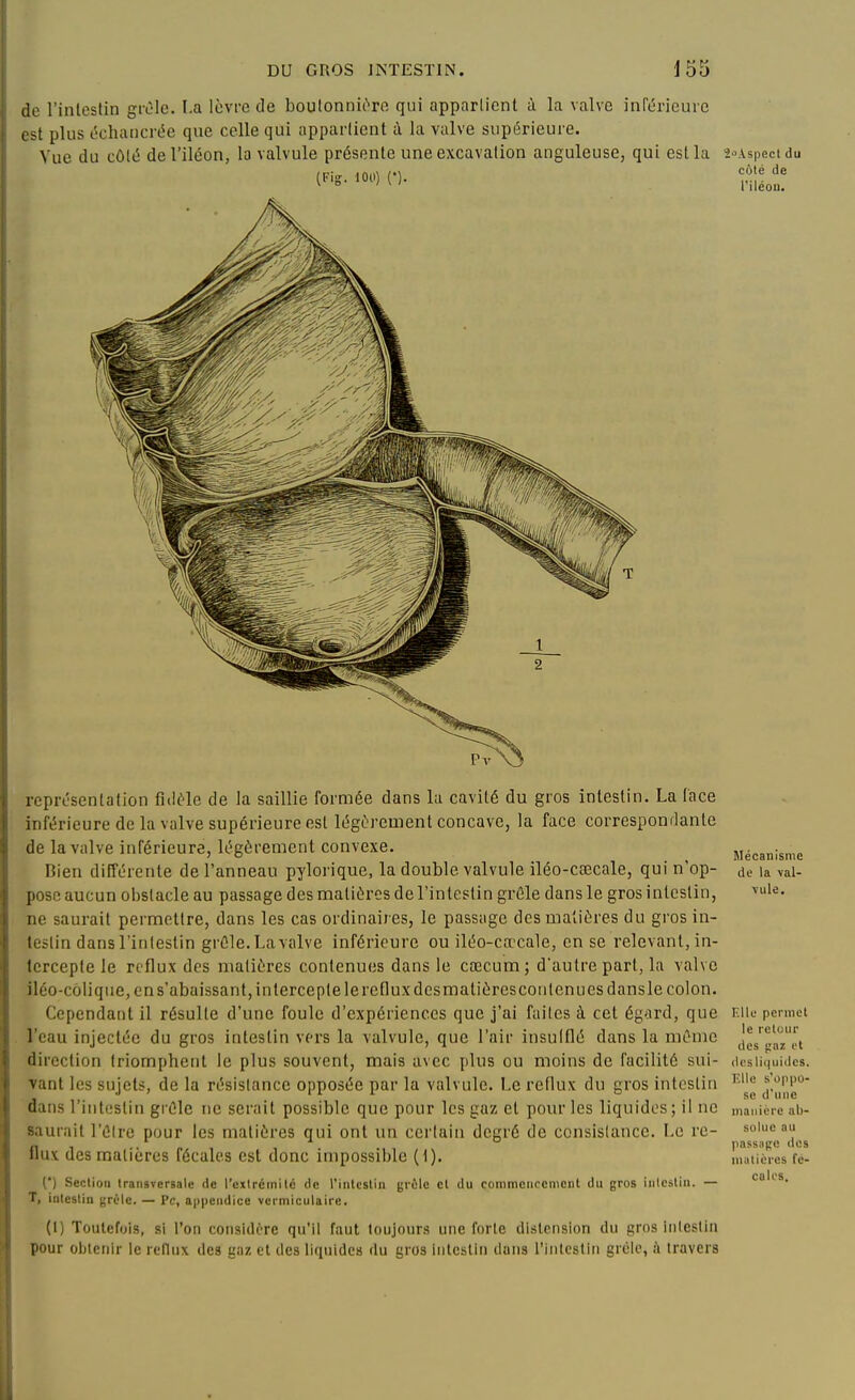 de l'inleslin grêle. I.a lèvre de boulonnu'ro qui appartient à la valve inrt5rieurc i st plus échancrt^e que celle qui apparlient à la valve supérieure. Vue du cùlÉ de l'iléon, la valvule présente une excavation anguleuse, qui est la s-Aspecidu (Fis. 100) (.). f;^^ représentation fide-le de la saillie formée dans la cavité du gros intestin. La (ace inférieure de la valve supérieure est légèrement concave, la face correspondante de la valve inférieure, légèrement convexe. Bien différente de l'anneau pyloi'ique, la double valvule iléo-csecale, qui n'op- pose aucun obstacle au passage des matières de l'intestin grêle dans le gros intestin, ne saurait permettre, dans les cas ordinaires, le passage des matières du gros in- testin dans l'intestin grêle. La valve inférieure ou iléo-ca?cale, en se relevant, in- tercepte le reflux des matières contenues dans le cœcum; d'autre part, la valve iléo-coli que, en s'abaissant, intercepte le reflux desmatières cou tenues dansle colon. Cependant il résulte d'une foule d'expériences que j'ai faites à cet égard, que l'eau injectée du gros intestin vers la valvule, que l'air insufflé dans la même direction triomphent le plus souvent, mais avec plus ou moins de facilité sui- vant les sujets, de la résistance opposée par la valvule. Le reflux du gros intestin dans l'intestin grêle ne serait possible que pour les gaz et pour les liquides ; il ne saurait l'être pour les matières qui ont un certain degré de consistance. Le re- flux des matières fécales est donc impossible (1). (*) Section transversale de l'extrémité de l'intestin grôlc et du commcncenicnt du gros intestin. — T, intestin grêle. — Pc, aiipendice vciniiculairc. (I) Toulefoi-s, si l'on considère qu'il faut toujours une forte distension du gros intestin pour obtenir le reflux des gaz et des liquides du gros inlcsliii dans l'intestin grèlc, fi travers Mécanisme de la val- vule. Elle pcrniel le retour des jiaz l't desliquides. lîUe s'oppo- se d'une manière ab- solue au passiipc des matières fé- cules.