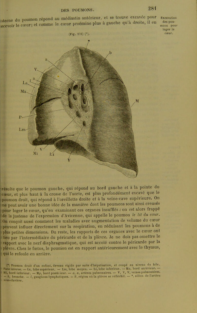 wornP da nouraon répond au médiastin antérieur, et se trouve excavée pour Rxcavaiion cevoi'-le cœur; et comme le cœur proémine plus à gauche qu'à droite, il en Jespo;^_, (Fig. 176) (*). loger le cœur. résulte que le poumon gauche, qui répond au bord gauche et à la pointe du cœur, et plus haut à la crosse de l'aorle, est plus profondément excavé que le poumon droit, qui répond à l'oreillette droite et à la veine-cave supérieure. On ne peut avoir une bonne idée de la manière dont les poumons sont ainsi creusés pour loger le cœur, qu'en examinant ces organes insufflés : on est alors frappé : de la justesse de l'expression d'Avicenne, qui appelle le poumon le lit du cœur. On conçoit aussi comment les maladies avec augmentation de volume du cœur peuvent influer directement sur la respiration, en réduisant les poumons à de \ plus petites dimensions. Du reste, les rapports de ces organes avec le cœur ont lieu par l'intermédiaire du péricarde et de la plèvre. Je ne dois pas omettre le «•apport avec le nerf diaphragraatique, qui est accolé contre le péricarde par la plèvre. Chez le fœtus, le poumon est en rapport antérieurement avec le thymus, qui le refoule en arrière. (*) Poumon droit d'un eiifaiil, devenu rigide par suite d'hépatisation, et coupé au niveau du hile. Face intpnie. — U, lobe supérieur. — hm, hhc moyen. — Lt, \ohe inférieur. — Mn, bord aniéricur. — Hi, bord inférieur. — Mp, bord postéi ieur. — a, a, artères pulmonaires. — V, V, V, veines pulmonaires. - 6, bronche. — /, ganglions lymphatiques. — 1', région où la plèvre se réiléchit. — sillon de l'artorc «ous-clavière.