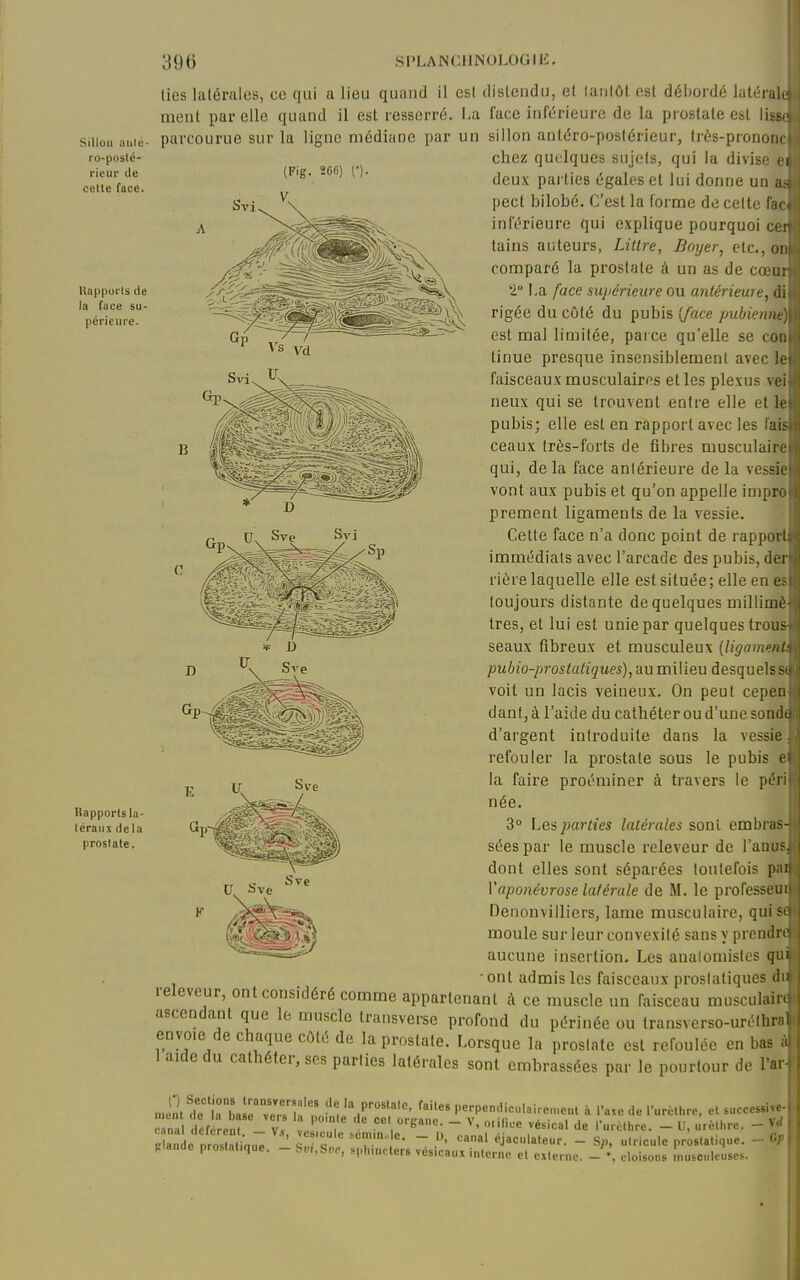 Sillon oule- ro-poslé- rieur de celle face. Ilapput'ls de la face su- périeure. Kapporls la- téraux de la prostate. lies latérales, ce qui a lieu quand il est disleiidu, el luiilôt est débordé latérale ment par elle quand il est resserré. La face inférieure de la prostate est lisw parcourue sur la ligne médiane par un sillon anléro-poslérieur, très-prononc chez quelques sujets, qui la divise ei deux parties égales et lui donne un pect bilobé. C'est la forme de celte faci inférieure qui explique pourquoi cer tains auteurs, Litlre, Bayer, etc., on comparé la prostate à un as de cœur 2° La face sujiérieure ou antérieure, di rigée du côté du pubis {face pubienne) est mal limitée, parce qu'elle se con Unue presque insensiblement avec le faisceaux musculaires elles plexus vei neux qui se trouvent entre elle elle pubis; elle est en rapport avec les fais ceaux très-forts de fibres musculaire qui, delà face antérieure de la vessie vont aux pubis et qu'on appelle impro premenl ligaments de la vessie. Cette face n'a donc point de rapport immédiats avec l'arcade des pubis, der riére laquelle elle est située; elle en es toujours distante de quelques uiillimè 1res, el lui est unie par quelques trous seaux fibreux et musculeux [ligament pubio-prostatiques), au milieu desquelss( voit un lacis veineux. On peut cepen dant, à l'aide du cathéter ou d'une sond< d'argent introduite dans la vessie refouler la prostate sous le pubis e' la faire proéminer à travers le péri née. 3° Les parûtes latérales sont embras- sées par le muscle releveur de l'anus dont elles sont séparées toutefois pai Vaponévrose latérale de M. le professeui Denonvilliers, lame musculaire, qui» moule sur leur convexité sans y prendre aucune insertion. Les analomistes qu • ont admis les faisceaux prostatiques du releveur, ont considéré comme appartenant à ce muscle un faisceau musculain ascendant que le muscle Iransverse profond du périnée ou transverso-uréthra. envoie de chaque côté de la prostate. Lorsque la prostate est refoulée en bas à j 1 aide du cathéter, ses parties latérales sont embrassées par le pourtour de l'ar- ! ■ninl t iTba verT n '^P-^' Perpendiculaire„,c„t à Taxe de ruréthre, et successive-  na cf .reïr v7 v ^ T  ■'B''''-  V. o.ilice vésical de furéthre. - U, uréthre. - V</ Xde nrosL in.;; ' l  «J^^'-'aleur. - S;,, u.ricule prostatique. - GT plande prostal.que. - Sm,S«., sph.ucters vésicaux interne et externe. - •. cloisons nusculeusos.