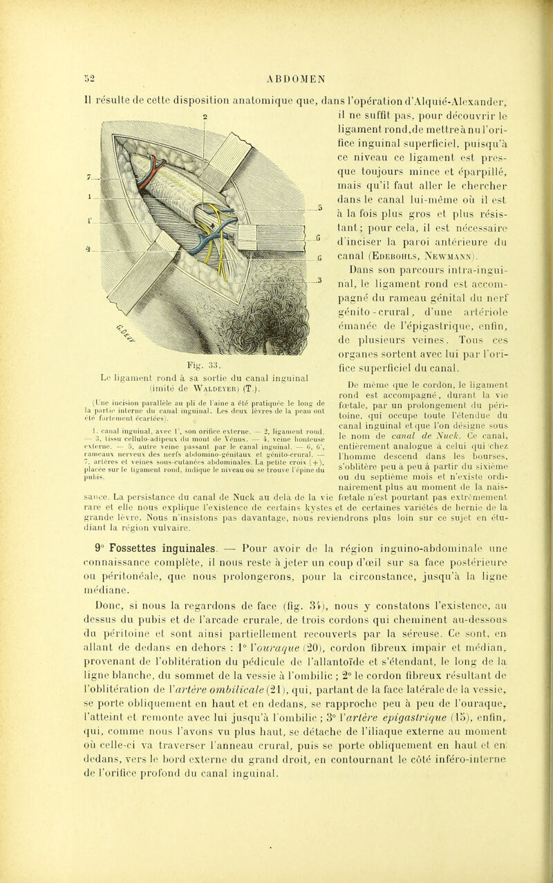 Il résulte de cette disposition anatomique que, dans l'opération d'Alquié-Alexander, il ne suffit pas, pour découvrir le ligament rond,de mettre à nu l'ori- fice inguinal superficiel, puisqu'à ce niveau ce ligament est pres- que toujours mince et éparpillé, mais qu'il faut aller le chercher dans le canal lui-même où il est à la fois plus gros et plus résis- tant; pour cela, il est nécessaire d'inciser la paroi antérieure du canal (Edebohls, NEWMAiNN). Dans son parcours intra-ingui- nal, le ligament rond est accom- pagné du rameau génital du nerf génito - crural, d'une artériole émanée de l'épigastrique, enfin, de plusieurs veines. Tous ces organes sortent avec lui par Fori- fice superficiel du canal. Fig. 33. Le liganifiit rond à sa sortie du canal inguinal (imité de Waldeyer) (T.). (Une incision parallèle au pli de l'aine a été pratiquée le long de la partie interne du canal inguinal. Les deux lèvres de la peau ont été fortement écartées). 1. canal inguinal, avec 1', son orifice externe. — 2, ligament rond. — 3, tissu cellulo-adipeux dn mont de Vénus. — 4, veine honteuse externe. — 5, autre veine passant par le canal inguinal. — C, 0', rameaux nerveux des nerl's atidomino-génitaux et génito-crural. — 7, artères et veines sous-cutanées abdominales. La petite croix ( + ), placée sur le ligament rond, indique le niveau où se trouve l'épine du pubis. De même que le cordon, le ligament rond est accompagné, durant la vie fœtale, par un prolongement du péri- toine, qui occupe toute l'étendue du canal inguinal et que l'on désigne sous le nom de canal de Nuck. Ce canal, entièrement analogue à celui qui chez; l'homme descend dans les bourses, s'oblitère peu à peu à partir du sixième ou du septième mois et n'existe ordi- nairement plus au moment de la nais- sance. La persistance du canal de Nuck au delà de la vie fœtale n'est pourtant pas extrêmement rare et elle nous explique l'existence de certains kj'stes et de certaines variétés de liernie de la grande lèvre. Nous n'insistons pas davantage, nous reviendrons plus loin sur ce sujet en étu- diant la région vulvaire. 9° Fossettes inguinales. — Pour avoir de la région inguino-abdominale une connaissance complète, il nous reste à jeter un coup d'œil sur sa face postérieure ou péritonéale, que nous prolongerons, pour la circonstance, jusqu'à la ligne médiane. Donc, si nous la regardons de face (fig. 3V), nous y constatons l'existence, au dessus du pubis et de l'arcade crurale, de trois cordons qui cheminent au-dessous du péritoine et sont ainsi partiellement recouverts par la séreuse. Ce sont, en allant de dedans en dehors : 1 Vouraqiie (i20), cordon fibreux impair et médian, provenant de l'oblitération du pédicule de l'allantoïde et s'étendant, le long de la ligne blanche, du sommet de la vessie à l'ombilic ; 2° le cordon fibreux résultant de l'oblitération de Vartère ombilicale (21), qui, partant de la face latérale de la vessie, se porte obliquement en haut et en dedans, se rapproche peu à peu de l'ouraque, l'atteint et remonte avec lui jusqu'à l'ombilic ; 3° VaiHère épigaslrique (15), enfin, qui, comme nous l'avons vu plus haut, se détache de l'iliaque externe au moment où celle-ci va traverser l'anneau crural, puis se porte obliquement en haut et en; dedans, vers le bord externe du grand droit, en contournant le côté inféro-interne de l'oriiice profond du canal inguinal. :