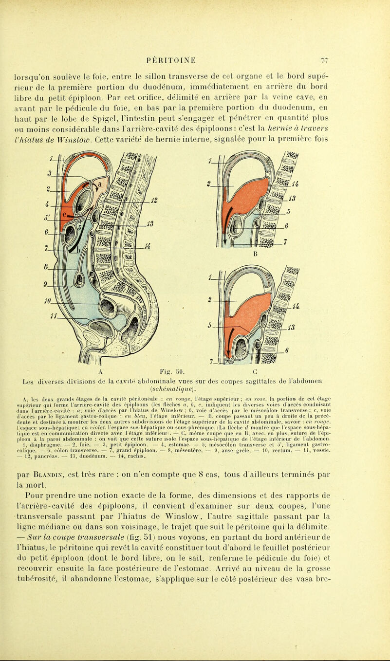 lorsqu'on soulève le foie, entre le sillon transverse de cet organe et le bord supé- rieur de la première portion du duodénum, immédiatement en arrière du bord libre du petit épiploon. Par cet orifice, délimité en arrière par la veine cave, en avant par le pédicule du foie, en bas par la première portion du duodénum, en haut par le lobe de Spigel, l'intestin peut s'engager et pénétrer en quantité plus ou moins considérable dans l'arrière-cavité des épiploons: c'est la hernie à travers Vhiatus de Winslow. Cette variété de hernie interne, signalée pour la première fois A Fig. SO. G Les diverses divisions de la cavitn abdominale vues sur des coupes sagiltales de l'abdomen (schématique). A, les deux grands étages de la cavité péritonéale : en rouge, l'étage supérieur; en rose, la portion de cet étage supérieur qui l'orme l'arriére-cavité des épiploons (les flèches a, Ij, c. indiquent les diverses voies d'accès conduisant dans l'arrière-cavilé : «, voie d'accès par l'hiatus de Winslow; 6, voie «l'accès par le mésocôloii transverse; c, voie d'accès par le ligament gastro-colique : en bleu, l'étage inférieur. — B, coupe passant un peu à droite de la précé- dente et destinée à montrer les deux autres subdivisions de l'étage supérieur de la cavité abdominale, savoir : en rouge, l'espace sous-hépatique; en violet, l'espace siis-hépali(|ue ou sous-phrénique. (La flèche d montre que l'espace sous-hépa- tique est en communication directe avec l'étage inférieur!. — C, même coupe que en B, avec, en plus, suture de Tépi- ploon à la paroi abdominale : on voit que cette suture isole l'espace sous-liépaliquc de l'étage inlérieur de l'abdomen. 1, diaphragme. — 2, foie. — 3, petit épiploon. — 4, estomac. — 3, mésocôlon transverse et o', ligament gastro- colique. — 6, côlon Iransverse. — 7, grand épiploon. — 8, mésentère. — 9, anse grêle. — 10, rectum. — li, vessie. — 12, pancréas. — 13, duodénum. — 14, rachis. par Bl.\ndi\, est très rare : on n'en compte que 8 cas, tous d'ailleurs terminés par la mort. Pour prendre une notion exacte de la forme, des dimensions et des rapports de l'arrière-cavité des épiploons, il convient d'examiner sur deux coupes, l'une •transversale passant par l'hiatus de 'Winslo'w, l'autre sagittale passant par la ligne médiane ou dans son voisinage, le trajet que suit le péritoine qui la délimite. — Sur la coupe transuersale (fig. 51 j nous voyons, en partant du bord antérieur de l'hiatus, le péritoine qui revêt la cavité constituer tout d'abord le feuillet postérieur du petit épiploon (dont le bord libre, on le sait, renferme le pédicule du foie) et recouvrir ensuite la face postérieure de l'estomac. Arrivé au niveau de la grosse tubérosité, il abandonne l'estomac, s'applique sur le côté postérieur des vasa bre-