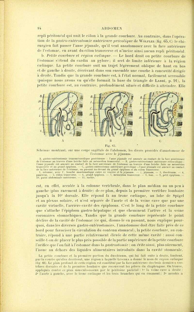 repli péritonéal qui unit le cùlon à la grande courbure. Au contraire, dans Topéra- tion de la ga&lro-enlérostoniie antérieure précolique de Wulfler (fig. 65, C) le chi- rurgien fait passer l'anse jëjunale, qu'il veut anastomoser avec la face antérieure de l'estomac, en avant du cùlon transverse et n'incise ainsi aucun repli péritonéal. b. Petite courbure et région cœliaque. — Le bord droit ou petite courbure de l'estomac s'étend du cardia au pylore; il sert de limite inférieure à la région cœliaque. La petite courbure suit un trajet légèrement oblique de haut en bas et de gauche à droite, décrivant dans son ensemble une courbe h. concavité dirigée à droite. Tandis que la grande courbure est, à l'état normal, facilement accessible (puisque nous avons vu qu'elle formait la base du triangle de Labbé, p. 91), la petite courbure est. au contraire, profondément située et difficile à atteindre. Elle A 13 c Fig. es. Schémas montrant, sur une coupe sagittale de l'abdomen, les divers procédés d'anastomose de l'estomac avec le jéjunum. .\. faslro-enléroslomie transmésocolique postérieure : l'anse jéjunale est amenée au contact de la face postérieure (le l'eslomac au travers d une brèctie faite au niésocolon transverse. — B, gastro-entérostomie antérieure rétrocolique ; l'anse jéjunale est amenée au contact de la face antérieure de l'estomac au travers d'une bi-cche faite au mésocolon transverr-e et au grand épiploon. — C, gaslro-cnlérostomie antérieure précolique i l'anse jéjunale est amenée au contact de la face antérieure de l'estomac, en passant au-devant du grand épiploon et du colon transverse. 1, estomac, avec 1'. bouche anastomotique entre ce viscère et le jéjunum. — i, jéjunum. — 3, duodénum. — 4, pancréas. — 5, côlon transverse. — G, grand épiploon. — 7, mésocôlon Iransvorse. — 8, l'oie. — 9, petit épiploon. — 10, paroi abdominale antérieure. — 11, racliis. est, en effet, accolée à la colonne vertébrale, dans le plan médian ou un peu à gauche (plus rarement adroite) de ce plan, depuis la première vertèbre lombaire jusqu'il la 10^ dorsale. Elle répond là au tronc cœliaque, au lobe de Spigel et au plexus solaire, et n'est séparée de l'aorte et de la veine cave que par une cavité virtuelle, l'arrière-cavité des épiploons. C'est le long de la petite courbure que s'attache l'épiploon gastro-hépatique , et que cheminent l'artère et la veine coronaires stomachiques. Tandis que la grande courbure représente le point déclive de la cavité de l'estomac (ce qui, disons-le en passant, nous explique pour- quoi, dans les diverses gastro-entérostomies, l'anastomose doit être faite près de ce bord pour favoriser la circulation du contenu stomacal), la petite courbure, au con- ti^aire, répond à une partie relativement élevée de cette même cavité : aussi con- seille-t-on de placer le plus près possible de la partie supérieure de la petite courbure l'orifice que l'on fait à l'estomac dans la gastroslornie : on évite ainsi, plus sûrement, l'issue au dehors des liquides alimentaires introduits dans la cavité stomacale. La petite courbure et la première portion du duodénum, qui lui l'ait suite à droite, limitent, par la courbe qu'elles décrivent, une région à laquelle Luschk.^ a donné le nom de région cœliaque (lig. 66). Le plan profond de cette région est constitué par la l'ace antérieure des trois dernières ver- tèbres dorsales et de la première lombaire que recouvrent les piliers du iliaphragme. On trouve, appliqués contre ce plan musculo-osseux par le péritoine pariétal : \° la veine cave à droite ; i l'aorte à gauche, avec le tronc cœliaque et les trois branches qui en émanent ; 3° accolés a