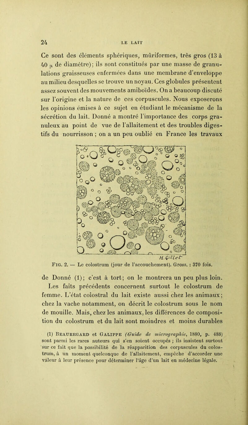 Ce sont des éléments sphériques, mûriformes, très gros (13 à 40 [j. de diamètre) ; ils sont constitués par une masse de granu- lations graisseuses enfermées dans une membrane d’enveloppe au milieu desquelles se trouve un noyau. Ces globules présentent assez souvent des mouvements amiboïdes. On a beaucoup discuté sur l’origine et la nature de ces corpuscules. Nous exposerons les opinions émises à ce sujet en étudiant le mécanisme de la sécrétion du lait. Donné a montré l’importance des corps gra- nuleux au point de vue de l’allaitement et des troubles diges- tifs du nourrisson ; on a un peu oublié en France les travaux Fig. 2. — Le colostrum (jour de l'accouchement). Gross. : 370 fois. de Donné (1); c’est à tort; on le montrera un peu plus loin. Les faits précédents concernent surtout le colostrum de femme. L’état colostral du lait existe aussi chez les animaux; chez la vache notamment, on décrit le colostrum sous le nom de mouille. Mais, chez les animaux, les différences de composi- tion du colostrum et du lait sont moindres et moins durables (1) Beauregakd et Galippe (Guide de micrographie, 1880, p. 488) sont parmi les rares auteurs qui s’en soient occupés ; ils insistent surtout sur ce fait que la possibilité de la réapparition des corpuscules du colos- trum, à un moment quelconque de l’allaitement, empêche d’accorder une valeur à leur présence pour déterminer l’âge d’un lait eu médecine légale.