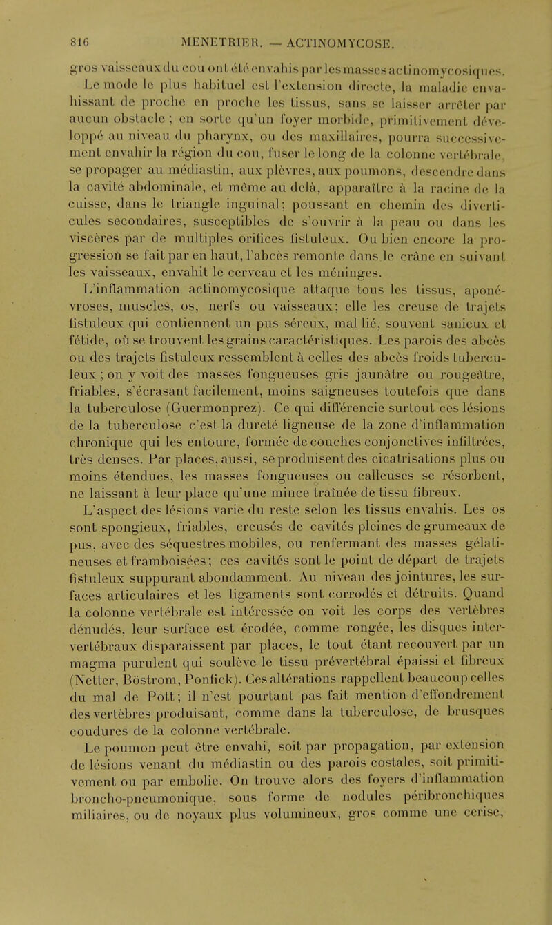 gros vaisseaux till cou onL 616 envahis par les masses aclinomycosiqucs. Lc mode le plus habiLuel csL i'exLension dirccLe, la maladic enva- hissanL de proche en prochc les lissus, sans se laisser arrOLer par aucun obstacle ; en sorLe qu'un foyer morbide, primilivemenl deve- loppc au niveau du pharynx, ou dcs maxillaircs, pourra successivc- mcnL envahir la region du con, (user le long de la colonne verlebrale. se propager au mediasLin, aux plevres, aux poumons, descendredans la cavit6 abdominale, et m6me au deli, apparaiLre k la racine de la cuisse, dans le triangle inguinal; poussant en chemin dcs diverti- cules secondaires, susceptibles de s'ouvrir a la peau ou dans les visceres par de multiples orifices fistuleux. Ou bien encore la pro- gression se fait par en haut, Fabces remonte dans le crane en suivant les vaisscaux, envahit le cerveau et les meninges. L'inflammation actinoraycosique attaque tons les tissus, apon6- vroses, muscles, os, nerfs ou vaisseaux; elle les creuse de trajets fistuleux qui contiennent un pus sereux, mal li6, souvent sanieux et fetide, ouse trouvent les grains caracteristiques. Les parois des abces ou des trajets fistuleux ressemblent a celles des abces I'roids tubercu- leux ; on y voit des masses fongueuses gris jaunfttre ou rougealre, friables, s'ecrasant facilement, moins saigneuses toutefois que dans la tuberculose (Guermonprez). Ce qui ditlerencie surtout ces lesions de la tuberculose c'est la durete ligneuse de la zone d'inflammation chronique qui les entoure, formee de couches conjonctives infiltrees, tres denses. Par places, aussi, seproduisentdes cicatrisations plus ou moins etendues, les masses fongueuses ou calleuses se resorbent, ne laissant a leur place qu'une mince trainee de tissu fibreux. L'aspect des lesions varie du reste selon les tissus envahis. Les os sont spongieux, friables, creuses de cavites pleines de grumeaux de pus, avec des sequestres mobiles, ou renfermant des masses gclati- neuses et framboisees; ces cavites sont le point de depart de trajets fistuleux suppurant abondamment. Au niveau des jointures, les sur- faces articulaires et les ligaments sont corrodes et detruits. Quand la colonne vertebrale est interessee on voit les corps des vertebres d6nudes, leur surface est crodee, comme rongee, les disques inter- vertebraux disparaissent par places, le tout etant recouvcrt par un magma purulent qui souleve le tissu prevertebral epaissi et fibreux (Netter, Bostrom, Ponfick). Ces alterations rappellent beaucoup celles du mal de Pott; il n'est pourtant pas fait mention d'effondrement des vertebres produisant, comme dans la tuberculose, de brusques coudures de la colonne vertebrale. Le poumon pent etre envahi, soit par propagation, par extension de lesions vcnant du mediastin ou des parois costales, soit primiti- vement ou par embolic. On trouve alors des foyers d'inflammation broncho-pneumonique, sous forme de nodules p6ribronchiques miliaires, ou de noyaux plus volumineux, gros comme une cerise,