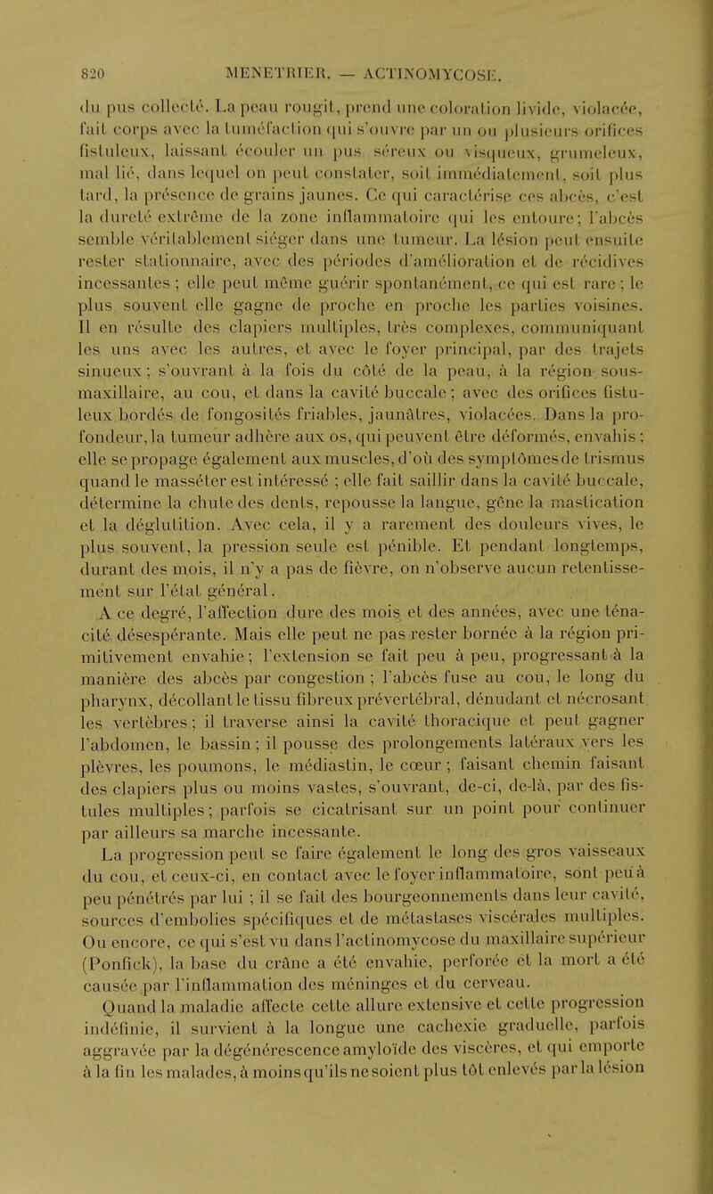 du pus collecte. La pcau rougil, prciul une coloration lividc, violacee, fait corps avec la lumcracUon qui s'om re par un ou piusiours orifices fisUileiix, laissanL ecouler iiii pus screux ou ^isqucux, grumelcux, nial lie, dans leciuel on peuL consLaLer, soil immedialcmenl, soil plus lard, la presence dc grains jaunes. Ce qui caracL^risc ces abces, c'est la durete extreme de la zone innammaLoire qui Ics entoure; Tabces semble veritablcment sieger dans une lumeur. La 16sion pcul ensuile rester slaLionnaire, avec des periodes d'ami^lioration et de recidives incessanles ; elle pent mSme gu6rir sponlanement, ce qui est rare; le plus souvent elle gagne de proche en proche les parties voisines. II en resulte des clapiers multiples, Ires complexes, communiquant les uns avec les autres, et avec le foyer principal, par des trajets sinueux; s'ouvrant a la fois du cdte de la peau, a la region, sous- maxillaire, au cou, et dans la cavil6 buccale; avec des orifices fislu- leux bordeS: de fongosites friables, jaunatres, violac6es. Dans la pro- fondeur,la tumeur adhere aux os, qui peuvent etre d^formes, envahis; elle se propage egalement aux muscles, d'oii des symptdniesde trismus quand le masseter est interesse ; elle fait saillir dans la cavilc buccale, determine la chute des dents, repousse la langue, gene la mastication et la deglutition. Avec cela, il y a rarement des douleurs vives, le plus souvent, la pression seule est penible. Et pendant longtemps, durant des mois, il n'y a pas de fi6vre, on n'observe aucun retenlisse- ment sur Fetat general. A ce degre, Faffection dure des mois. et des annees, avec une tena- city desesperante. Mais elle pent ne pas rester bornee k la r('gion pri- mitivement envahie; Fextension se fait pen a peu, progressant^ la maniere des abc^s par congestion; Fabces fuse au cou, le long du pharynx, d^collantle tissu fibreux prevertebral, denudant et necrosant les vertebres; il traverse ainsi la cavit6 thoracique et pent gagner Fabdomen, le bassin; il pousse des prolongements lateraux .vers les plevres, les poumons, le mediastin, le coeur ; faisant chcmin faisant des clapiers plus ou moins vastes, s'ouvrant, de-ci, de-la, par des fis- tules multiples; parfois se cicatrisant sur un point pour continuer par ailleurs sa marche incessante. La progression pent se faire 6galement le long des gros vaisseaux du cou, el ceux-ci, en contact avec le foyer inflammatoire, sont petia peu penetres par lui ; il se fait des bourgeonnements dans leur cavite, sources d'embolies specifiques el de metastases viscerales multiples. Ou encore, ce qui s'esl vu dans Factinomycose du maxillairc superieur (Ponfick), la base du crane a ete envahie, perforce el la mort a ete causec .par Finflammation des meninges et du cerveau. Quand la maladie affecte cette allure extensive el celte progression indefinie, il survienl k la longue une cachexie graduelle, parfois aggrav6e par la deg6nerescence amylo'ide des visc6res, el qui empoiie ^ la fin les malades, moins qu'ils ne soienl plus t6t enlevc^s par la 16sion