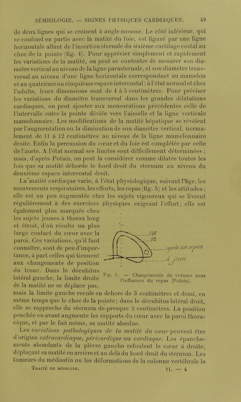 de deux lignes qui se croiscnt a angle mousse. Le c6le inferieur, qui se confond en partie avec la matite du foie, est figure par une ligne horizontalc allant de l'inscrlion slernale du sixieme cartilage costal au choc de la poinle (fig. 4). Pour apprecicr simplement et rapidement les variations de la matile\ on peut se contenter de inesurer son dia- metre vertical au niveau de la lig-ne parasternale, ct sondiam6tre trans- versal au niveau d'une ligne horizontale correspondant au mamelon el au quatriemeou cinquiemecspace intercostal: aFetalnormaletchez 1'adulle, leurs dimensions sont de 4 a 5 centimetres. Pour preciser les variations du diametre transversal dans les grandes dilatations cardiaques, on peut ajouter aux mensurations precedenles celle de I'intervalle entre la pointe deviee vers l'aisselle et la ligne verticale mamelonnaire. Les modifications de la malile hepatique se revelent par Faugmentation ou la diminution de son diametre vertical, norma- lement de 11 a 12 centimetres au niveau de la ligne mamelonnaire droite. Enfin la percussion du cceur et du foie est complelee par celle del'aorte. A 1'etat normal ses limites sont difficilement determinees ; mais, d'apres Potain, on peut la considerer comme dilatee toutes les fois que sa matite deborde le bord droit du sternum au niveau du deuxieme espace intercostal droit. La'matite cardiaque varie, a Petal physiologique, suivant Page, les mouvements respiratoires,les efforts, lesrepas (fig. 5) et les attitudes ; elle est un peu augmentee chez les sujets vigoureux qui se livrent regulierement a des exercices physiques exigeant Feffort; elle est egalement plus marquee chez les sujets jeunes a thorax long et etroit, d'oii resulte un plus V large contact du cceur avec la J';^ paroi. Ces variations, qu'il faut //| ^vX^ connaitre, sont de peu d'impor- apresiL/uvjjas lance, a part celles qui tiennent j J aux changements de position du tronc. Dans le decubitus lateral o-inrhp la limilP rlrnUo Fl°- 5- ~ Chan»cmenLs de volume sous Jaierai gauclie, la limite droite l'influence du repas (Potain). de la matite ne se deplace pas, mais la limite gauche recule en dehors de 3 centimetres et demi, en nirme temps que le chocde la pointe; dans le decubitus lateral droit, elle se rapproche du sternum de.presque 2 centimetres. La position penchee en avant augmente les rapports du cceur avec la paroi thora- cique, et par le fait meme, sa matite absolue. Les variations palhologiques de la malitc du cceur peuvenl 6tre d'origine exlracardiaque, pericardique ou cardiaque. Les epanche- ments abondants de la plevre gauche refoulent le cceur a droite, ddplagantsamatite enarriereetau deladu bord droit du sternum. Les tumeurs du mediastin ou les deformations de la colonne vertebralc lo ThAITE I)E MEDEC1NE. yj, 4 a iciin.