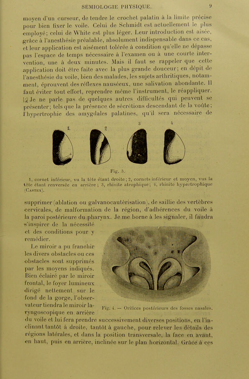 moyen d'un curseur, de tendre le crochet palalin a la limite precise pour bien fixer le voile. Celui de Schmidt est acluellemcnt le plus employe; celui de White est plus leger. Leur introduction est aisee, grace a l'anesthesie prealable, absolument indispensable dans ce cas, et leur application est aisement toleree a condition qu'elle nc depasse pas l'espace de temps necessaire a l'examen ou a une courte inter- vention, une a deux minutes. Mais il faut se rappeler que cette application doit elre faite avec la plus grande douceur; en depit de l'anesthesie du voile, bien des malades, les sujets arthritiques, notam- ment, eprouvent des reflexes nauseeux, une salivation abondante. 11 faut eviter tout effort, reprendre meme Finstrument, le reappliquer. yje ne parle pas de quelques autres difficultes qui peuvent se presenter; tels que la presence de secretions descendant de la voute; i'hypertrophie des amygdales palatines, qu'il sera necessaire de Fig. 3. 1, cornet inferieur, vu la tele elant droite; 2, cornets interieur et moyen, vus la tete etant renversee en arriere ; 3, rhinite atrophique; i, rhinite hypertrophique (Castex). supprimer (ablation ou galvanocauterisation), de saillie des vertebres cervicales, de malformation de la region, d'adherences du voile a la paroi posterieure du pharynx. Je me borne a les signaler, il faudra s'inspirer de la necessite et des conditions pour y remedier. Le miroir a pu franchir les divers obstacles ou ces obstacles sont supprimes par les moyens indiques. Bien eclair6 par le miroir frontal, le foyer lumineux dirige netlement sur le fond de la gorge, Fobser- valeur tiendra le miroir la- ryngoscopique en arriere du voile et lui fera prendre successivement diverses positions, en Fin- elinant tant6t a droite, tantdt a gauche, pour relever les details des regions laterales, et dans la position transversale, la face en avant, en haut, puis en arriere, inclinee sur le plan horizontal. (Irace a ces Fig-. 4. — Oriliccs posteiieurs des fosses nasales.