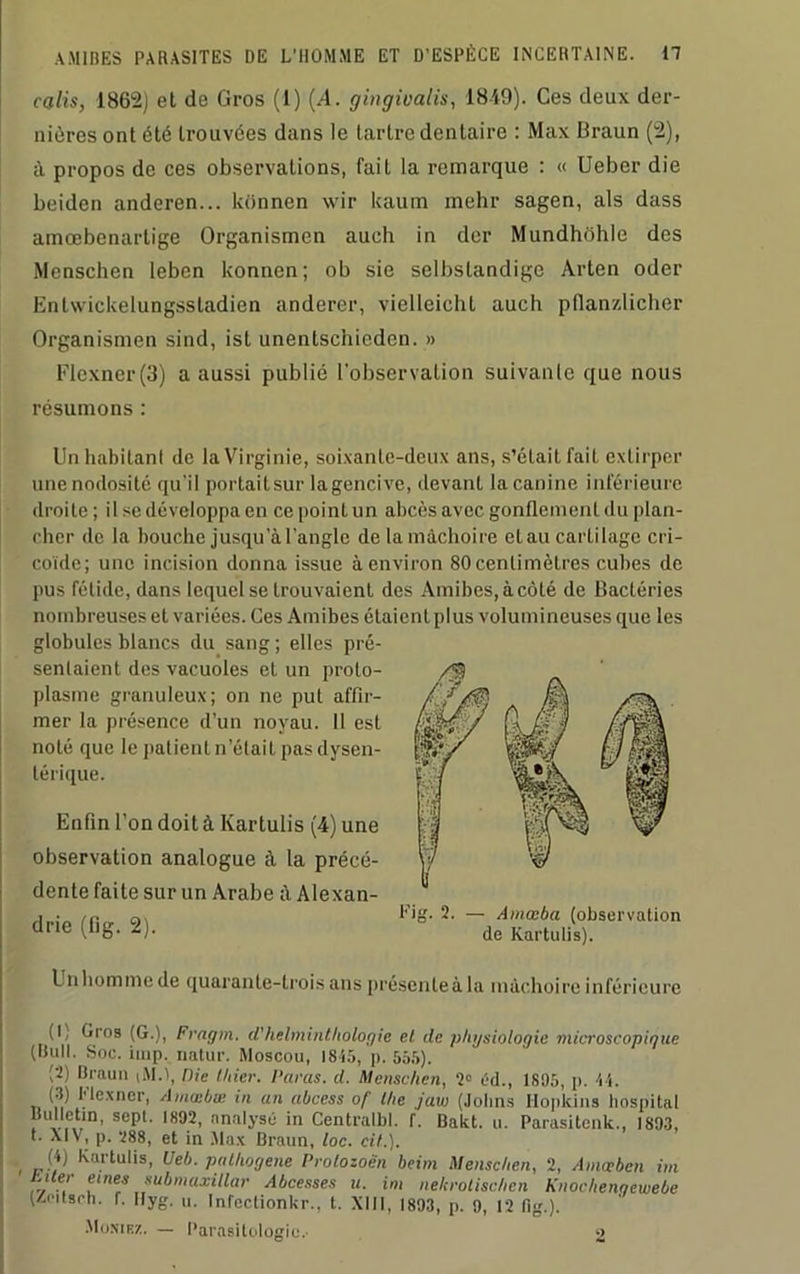 calis, 1862) et de Gros (1) (A. gingivalis, 1849). Ces deux der- nières ont été trouvées dans le tartre dentaire : Max Braun (2), à propos de ces observations, fait la remarque : « Ueber die beiden anderen... konnen wir kaum mehr sagen, als dass amœbenartige Organismen auch in der Mundhôhle des Menschen leben konnen; ob sie selbstandige Àrten oder Entwickelungssladicn anderer, vielleicht auch pflanzlicher Organismen sind, ist unentschicden. » Flexner(3) a aussi publié l'observation suivante que nous résumons : Unhabitanl de la Virginie, soixante-deux ans, s’était fait extirper une nodosité qu’il portaitsur lagencive, devant la canine inférieure droite ; il se développa en ce [toini un abcès avec gonflement du plan- cher de la bouche jusqu’à l’angle de la mâchoire etau carlilage cri- coïde; une incision donna issue à environ 80centimètres cubes de pus fétide, dans lequel se trouvaient des Amibes,àcôté de Bactéries nombreuses et variées. Ces Amibes étaient plus volumineuses que les globules blancs du sang ; elles pré- sentaient des vacuoles et un proto- plasme granuleux; on ne put affir- mer la présence d’un noyau. Il est noté que le patient n’était pas dysen- térique. Enfin l’on doit à Kartulis (4) une observation analogue à la précé- dente faite sur un Arabe à Alexan- drie (fig. 2). l’ig. 2. — Amœba (observation de Kartulis). Unhomme de quarante-trois ans présenleàla mâchoire inférieure (1) Gros (G.), Fragm. d'helminthologie et de physiologie microscopique (Hull. Soc. imp. natur. Moscou, 1855, p. 555). (2) Braun iM.i, Die lliier. Paras, d. Menschen, 2° cd., 1S95, p. VI. (3) Flexncr, Amœbœ in un ubcess of the jaw (Jolms Hopkins hospital Bulletin, sept. 1892, analyse in Centralbl. r. Bakt. u. Parasitent, 1803, ‘ * P- -^8, et *n Max Braun, loc. cil.). , W Kartulis, Ueb. pathogène Prolozoèn beim Menschen, 2, Amæben im tuer eines submaxillar Abcesses u. im nekrolischen Knochengewebe (Zoitsrh. 1. Hyg. u. Infcctionkr., t. XIII, 1893, p. 9, 12 fig.). Monif.z. — Parasitologie.. 2