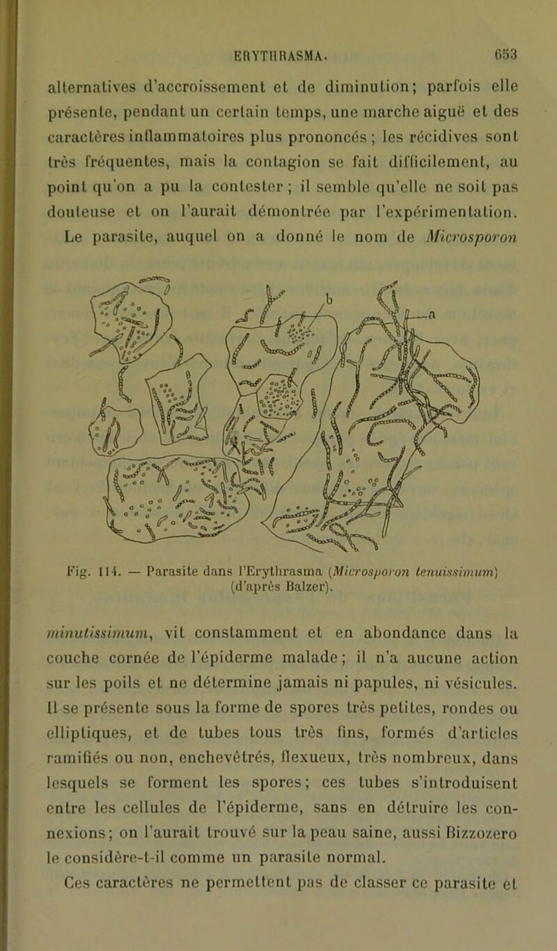 alternatives d’accroissement et de diminution; parfois elle présente, pendant un certain temps, une marche aiguë et des caractères inflammatoires plus prononcés; les récidives sont très fréquentes, mais la contagion se fait difficilement, au point qu'on a pu la contester; il semble qu’elle ne soit pas douteuse et on l’aurait démontrée par l’expérimentation. Le parasite, auquel on a donné le nom de Microsporon Fig. ll-i. — Parasite dans l'Erythrasma (Microsporon tenuissimum) (d’après Balzer). minulissimum, vit constamment et en abondance dans la couche cornée de l’épiderme malade ; il n’a aucune action sur les poils et ne détermine jamais ni papules, ni vésicules. Il se présente sous la forme de spores très petites, rondes ou elliptiques, et de tubes tous très fins, formés d’articles ramifiés ou non, enchevêtrés, llexueux, très nombreux, dans lesquels se forment les spores; ces tubes s’introduisent entre les cellules de l’épiderme, sans en détruire les con- nexions; on l’aurait trouvé sur la peau saine, aussi Bizzozero le considère-t-il comme un parasite normal. Ces caractères ne permettent pas de classer ce parasite et