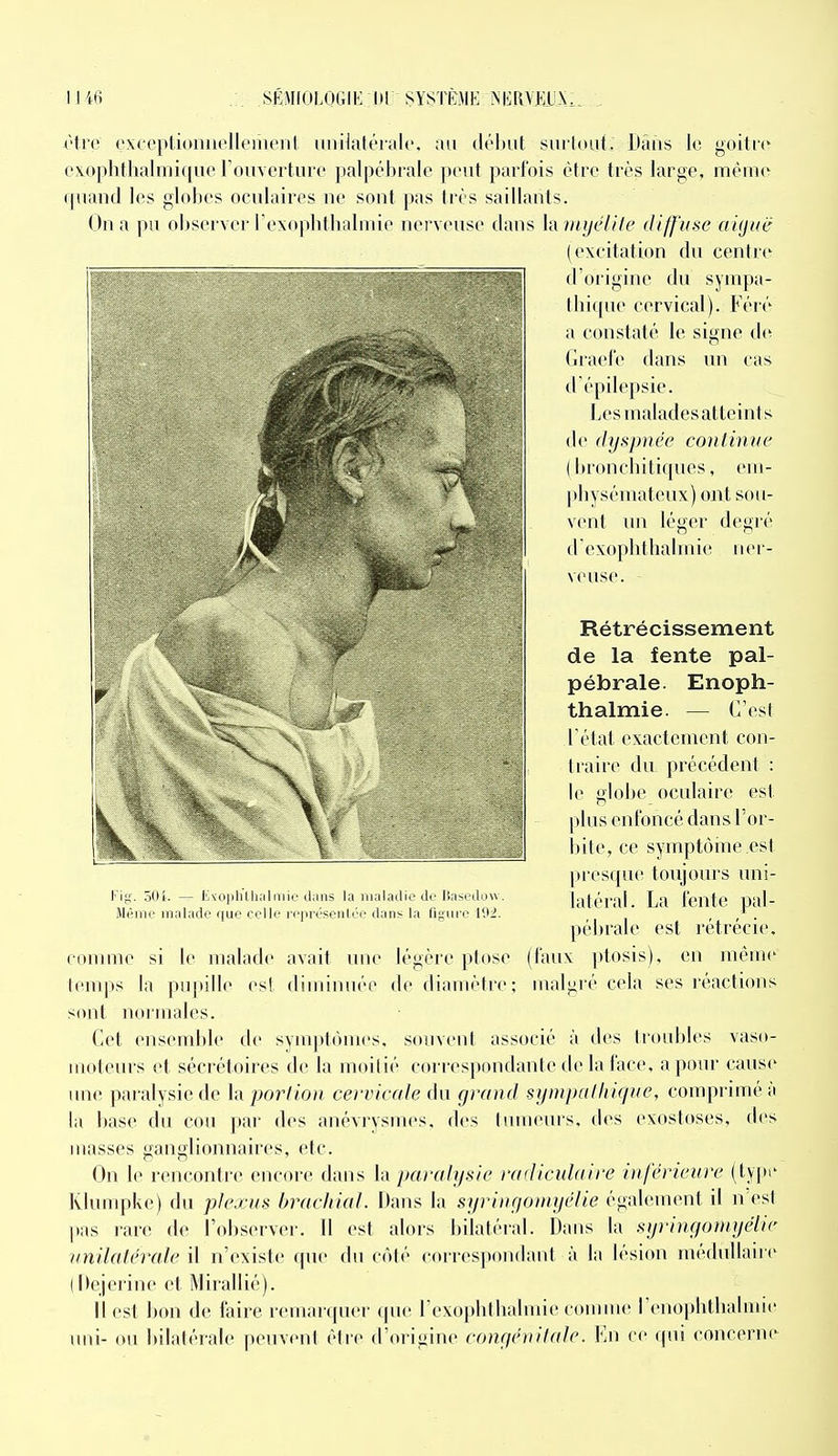 vire: exccptionnellemenl unilatérak. an (lél)ut surlouf. Dans le goitre c\oplifhalmi(|ue ronverturc palpcbrale pcMit parfois être très large, même (piand les glolies oeulaires ne sont pas très saillants. On a pu observer rexoplitlialmie nerveuse dans Vd inijelile diffuse aujuë (exeitation du centre d'origine du sympa- llii([ne cervical). Féré a constaté le signe (.le Graefe dans un cas d èpilepsie. J.esrnaladesatteints de dyspnée continue ( bronchitiques, em- physémateux) ont sou- vent un léger degré dexoplithalmie ner- veuse. Rétrécissement de la fente pal- pébrale. Enoph- thalmie. — C'esl Tétai exactement con- li aire du précédent : le globe oculaire est plus enfoncé dans l'or- liile, ce symptôine est [x escpie toujours uni- latéral. La fente pal- pébrale est rétrécie, eonune si le malade avait une légère ptôse (faux ptosis), en même temps la pupille est dimiiuiée de diamètre; malgré cela ses réactions sont noiTUiiles. Cet ensemble de symplùuies. souvent associé à des troubles vaso- moteurs et sécrétoires de la m(Hlié coi i-es|)ondante de la face, a pour cause une pai'alysiede \{i portion cervicale dn grand si/inpalhiqne, comprimé à la base du cou par des anévrysnies, des luineuis, des exostoses, des masses ganglionnaires, etc. On le rencontre encore dans \a paralysie radiculaire inférieure (typi' Klumpke) du plexus hracliial. Dans la syriiigouiyélie également il n esl pas rare de l'observer. Il est alors bilatéral. Dans la syringoniyélic unilatérale il n'existe que du côté correspondant à la lésion médullaire (Dejerine et Mirallié). Il est bon de faire remarquer que rexophlhalmie comme renophthalmie uni- ou bilalérale peuvent être d'origine congénitale. Kn ce qui concerne Fig. 50i. — Exoplitliiiliiiie iliiiis la inalnilii.'de IJasetlow. Même maUicle que celle représeiiirc dans la figure 192.