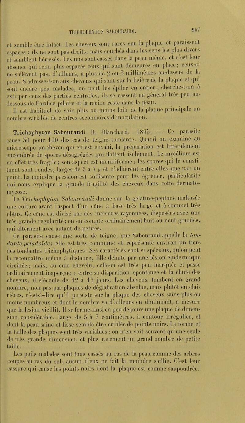 TRLCHOPHYTOPi SABOURAUDI. pi semble être intact. Les cheveux sont nues sur la plaque ël paraisse™ espacés : ils ne sont, pas droits, mais courbés dans les sous los plus divers Dl semblent hérissés. Les uns sont cassés dans la peau même, el c'est leur absence qui rend plus espacés ceux qui sont demeurés en place; ceux-ci ne s'élèvent pas, d'ailleurs, à plus de 2 ou 3 millimètres au-dessus de la peau. S'adresse-t-on aux cheveux qui sont sur la lisière de la plaque et qui sont encore peu malades, on peut les épiler en entier; cherrhe-L-on à pxtirper ceux des parties centrales, ils se cassent en général très peu au- dessous de l'orifice pilaire et la racine reste dans la peau. Il est habituel de voir plus ou moins loin de la plaque principale un nombre variable de centres secondaires d'inoculation. Trichophyton Sabouraudi R. Blanchard, 1895. — Ce parasite cause 50 pour 100 des cas de teigne tondante. Quand on examine au microscope un cheveu qui en est envahi, la préparation est littéralement encombrée de spores désagrégées qui flottent isolément. Le mycélium est en effet très fragile; son aspect est moniliforme ; les spores qui le consti- tuent sont rondes, larges de 5 à 7 \j. et n'adhèrent entre elles que par un point. La moindre pression est suffisante pour les égrener, particularité qui nous explique la grande fragilité des cheveux dans cette dermato- mycose. Le Trichophijton Sabouraudi donne sur la gélatinc-peptone maltosée une culture ayant l'aspect d'un cône à base très large et à sommet très obtus. Ce cône est divisé par des incisures rayonnées, disposées avec une très grande régularité; on en compte ordinairement huit ou neuf grandes, qui alternent avec autant de petites. Ce parasite cause une sorte de teigne, que Sabouraud appelle la ton- dantepeladoïde; elle est très commune et représente environ un tiers des tondantes trichophytiques. Ses caractères sont si spéciaux, qu'on peut la reconnaître même à distance. Elle débute par une lésion épidermique circinée; mais, au cuir chevelu, celle-ci est très peu marquée et passe ordinairement inaperçue : entre sa disparition spontanée et la chute des cheveux, il s'écoule de 12 à 15 jours. Les cheveux tombent en grand nombre, non pas par plaques de déglabration absolue, mais plutôt en clai- rières, c'est-à-dire qu'il persiste sur la plaque des cheveux sains plus ou moins nombreux et dont le nombre va d'ailleurs en diminuant, à mesure que la lésion vieillit. Il se forme ainsi en peu de jours une plaque de dimen- sion considérable, large de 5 à 7 centimètres, à contour irrégulier, el dont la peau saine et lisse semble être criblée de points noirs. La forme el la taille des plaques sont très variables : on n'en voit souvent qu'une seule de très grande dimension, et plus rarement un grand nombre de petite taille. Les poils malades sont tous cassés au ras de la peau comme des arbres coupés au ras du sol; aucun d'eux ne fait la moindre saillie. C'est leur cassure qui cause les points noirs dont la plaque est comme saupoudrée.