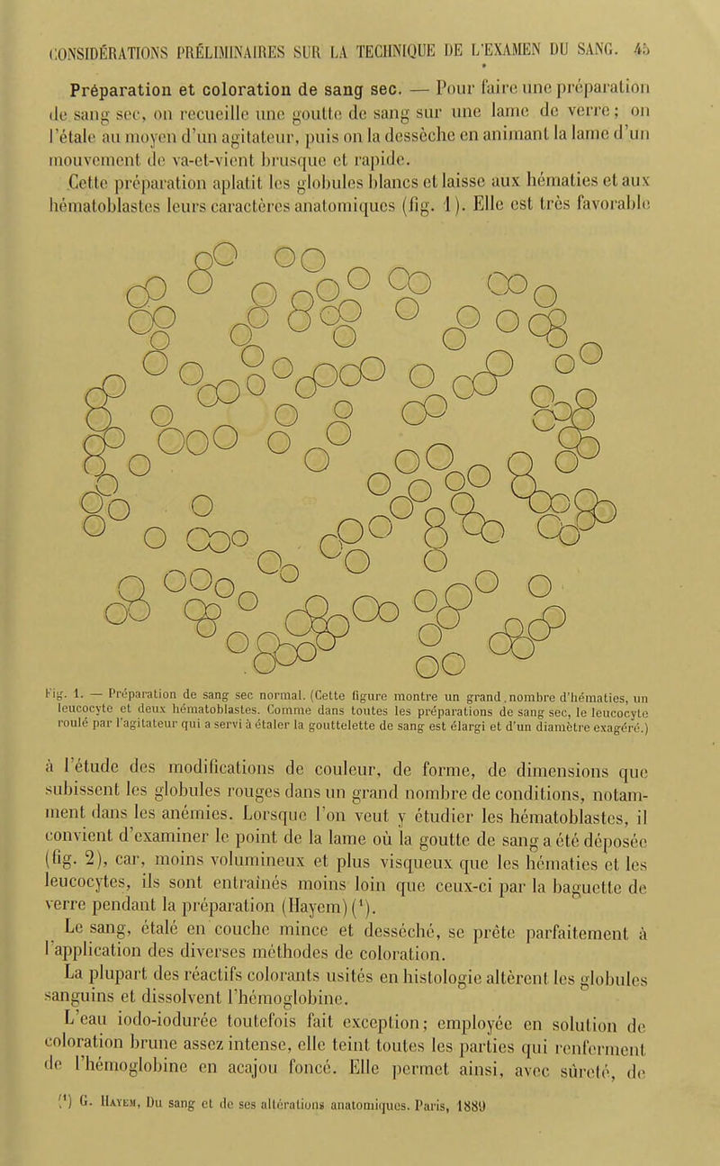 » Preparation et coloration de sang sec. — Pour faire une preparation de sang sec, on recueille une gouttc de sang sur une lame de verre; on Petale an moyen d’un agitateur, puis on la desseche en animant la lame d un mouvcment tit? va-et-vient brusque et rapide. Cette preparation aplatit les globules blancs et laisse aux hematies etaux hematoblastes Ieurs caractercs anatomiques (fig. 1). Elle est tres favorable I' 'd- Preparation de sang sec normal. (Cette figure montre un grand . nombre d’hematies, un leucocyte et deux hematoblastes. Comme dans toutes les preparations de sang sec, le leucocyte roule par l’agitateur qui a servi & etaler la gouttelette de sang est elargi et d’un diametre exagere.) a I etude des modifications de couleur, de forme, de dimensions quo subissent les globules rouges dans un grand nombre de conditions, notam- ment dans les anemies. Lorsque Ton veut y etudier les hematoblastes, il convient d examiner le point de la lame ou la goutte de sang a cte deposec (fig. 2), car, moins volumineux et plus visqueux quo les hematies et les leucocytes, ils sont entraines moins loin quo ceux-ci par la baguette de verre pendant la preparation (Ilayem) (*). Le sang, etale en couche mince et desseche, se prete parfaitement a 1 application des diverses metbodes de coloration. La plupart des reactifs colorants usites en bistologie alterent les globules sanguins et dissolvent rhemoglobine. L’eau iodo-ioduree toutefois fait exception; employee en solution de coloration brune assez intense, elle teint toutes les parties qui renferment de rhemoglobine en acajou fonce. Elle permet ainsi, avec surete, de M) G. IIayem, Du sang et de ses alterations anatoniiijues. Paris, 1889