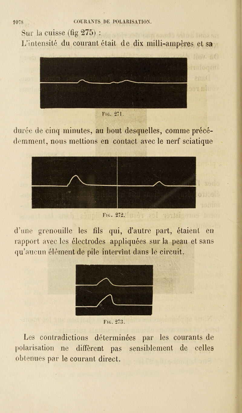 Sur la cuisse (fig 275) : J/intensité du courant était de dix milli-ampères et sa Fig. 271. durée de cinq minutes, au bout desquelles, comme précé- demment, nous mettions en contact avec le nerf sciatique Fig. 272. d’une grenouille les fils qui, d’autre part, étaient en rapport avec les électrodes appliquées sur la peau et sans qu’aucun élément de pile intervînt dans le circuit. Fig. 273. Les contradictions déterminées par les courants de polarisation ne diffèrent pas sensiblement de celles obtenues par le courant direct.