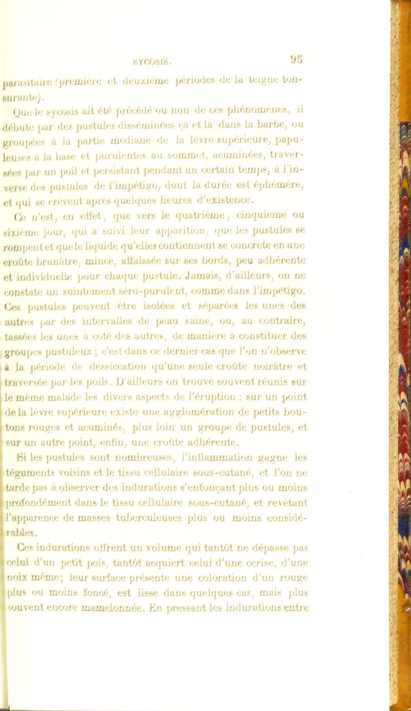 euj'ujjk'). (Jui; le sycobis ait été précMé ou non <1(; ces pJiénomeuiis, il déljiJt; jjai' des pustules <Jis.séminées eà et là dans la baj'be, ou groupées a la parti*; médiane du ia lèvre supéjieure, papu- leuses a la Ijase i.-t pnvub^nUtH, au sfjmmid, acuminées, ti'avec- sées par un poil et pej sistant pendant un certain temjjs, à l'in- verse d<;8 jjusLuies d«i l'impéti/^o, dont la dai-é<i est épliémere, et qui se crèvent après quelques iieuies d'<;xibtence. i'Ai n'est, en <llet, que vers le quatjième, cinquième ou sixième jouj-, qui a suivi leui- apjjaiition. que les pustules se rompent et <^uel<i liquide qu'elle» coutienniint se concrète en une croût*; Ijrunâtre, mince, affaissé*; sui' ses bords, peu adhérente et individueliii jjour cbatpjLe pustule. Jamai^s, d'ailieuj's, on ne constat*^ ujj suiiitemeijt séro-pul ulent, comme dans l'impétigo. Ce» pustules j:)euvent ètie isolées et séjjai'ées les unes dee autres jiaj- d«;s intervalles de peau saine, ou, au cjntraixe, tassées les unes à coté des autres, de manière à constituer des , groupe» jjustuleux; c'est dans ce derniej cas que l'on n'obwirve à la jjério<le de dessiccation qu'une seule croûte noirâtre et travei sée pur les poils. Jj'aiJIeurs on trouve souvent réunis sm- le même malad<; les div<;j s aspects d<; l'éj uption : sui' un point lie la lèvre sui)érieur(i existe uni; aj^gloméi-ation de petits bou- lons rouges (it acumiiiés, plus loin un groupe de pustules, et ! un autre jjoint, enlin, une <;r(jûte adhérente. Hi les pustules sont nombreuses, j'inllammatioji gagne les téguments voisins et le tissu ceiluiane sous-cutané, et l'on ne tarde pas à ol)server d<;s ijidui ations s'enloncant plus ou moins profondément dans le tissu cellulaire sous-cutané, et j'evètant l'apparence de masses tujjerculeuses plus ou moins considé- rables. Ces indurations oOrent un volume qui tantôt ne dépasse jjas 'ui d'un petit pois, tantôt acquiert celui d'une cerise, d'une ixméme; leur surtace présente une coloration d'un rouge js ou moins foncé, est lisse dans quelques cas, mais plus juvent encoi'e mamelonnée. En pressant les indoi'ations entx'e