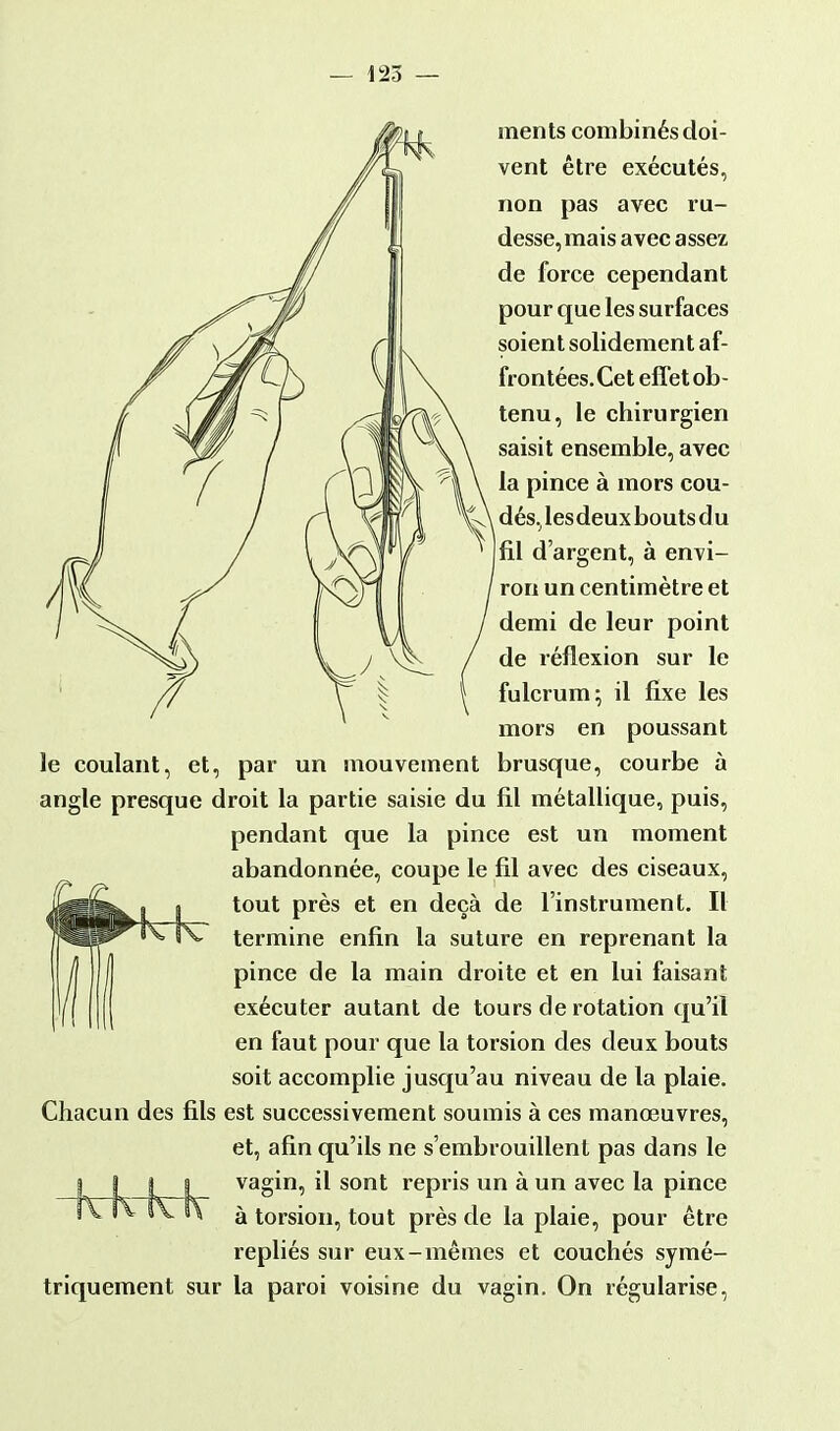 ments combinés doi- vent être exécutés, non pas avec ru- desse, mais avec assez de force cependant pour que les surfaces soient solidement af- frontées. Cet effet ob- tenu, le chirurgien saisit ensemble, avec la pince à mors cou- dés,lesdeuxboutsdu fil d'argent, à envi- ron un centimètre et demi de leur point de réflexion sur le fulcrum; il fixe les mors en poussant le coulant, et, par un mouvement brusque, courbe à angle presque droit la partie saisie du fil métallique, puis, pendant que la pince est un moment abandonnée, coupe le fil avec des ciseaux, tout près et en deçà de l'instrument. Il termine enfin la suture en reprenant la pince de la main droite et en lui faisant exécuter autant de tours de rotation qu'il en faut pour que la torsion des deux bouts soit accomplie jusqu'au niveau de la plaie. Chacun des fils est successivement soumis à ces manœuvres, et, afin qu'ils ne s'embrouillent pas dans le vagin, il sont repris un à un avec la pince à torsion, tout près de la plaie, pour être repliés sur eux-mêmes et couchés symé- triquement sur la paroi voisine du vagin. On régularise,