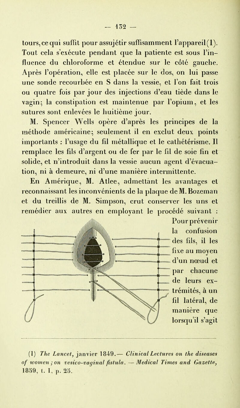 tours, ce qui suffit pour assujétir suffisamment l'appareil (1). Tout cela s'exécute pendant que la patiente est sous l'in- fluence du chloroforme et étendue sur le côté gauche. Après l'opération, elle est placée sur le dos, on lui passe une sonde recourbée en S dans la vessie, et l'on fait trois ou quatre fois par jour des injections d'eau tiède dans le vagin; la constipation est maintenue par l'opium, et les sutures sont enlevées le huitième jour. M. Spencer Wells opère d'après les principes de la méthode américaine; seulement il en exclut deux points importants : l'usage du fil métallique et le cathétérisme. Il remplace les fils d'argent ou de fer par le fil de soie fin et solide, et n'introduit dans la vessie aucun agent d'évacua- tion, ni à demeure, ni d'une manière intermittente. En Amérique, M. Atlee, admettant les avantages et reconnaissant les inconvénients de la plaque de M. Bozeman et du treillis de M. Simpson, crut conserver les uns et remédier aux autres en employant le procédé suivant : Pour prévenir la confusion des fils, il les fixe au moyen d'un nœud et par chacune de leurs ex- trémités, à un fil latéral, de manière que lorsqu'il s'agit (1) The Lancet, janvier 1849.— Clinical Lectures on the diseases of tvomen-on vesico-vaginal fistula. —Médical Times and Gazette, 1859, t. I, p. 25.