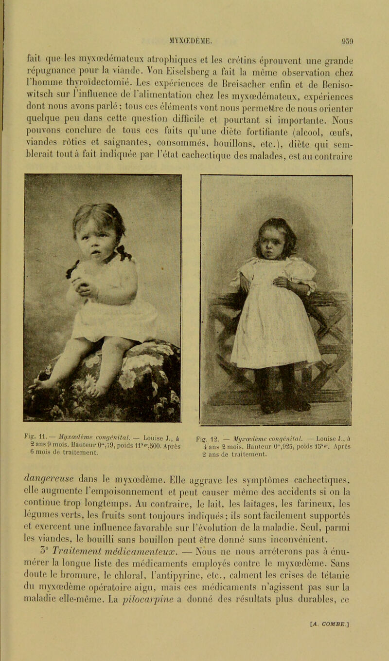 fait c[iic Ics myx(X'(](*inateux atrophiqucs ot los ciaHins (■prouvont une grande repugnance pour la viamle. Von hiselsl)crg a Tail la meinc observalion cliez 1 lioniine Ihjroidocloniie. Les experiences ile Hreisaclicr enfin et de Beniso- witscli sur 1 inlluence de 1 aliinenlation chcz les inyxoedeinateux, experiences dnnt nous a\ons parle; tons ces elements vont nous perineUrc de nous orienler quelque peu dans cette (picslion dilficile ct pourlant si iniportante. Nous pouvons conclui-c de tons cos fails fpi’unc dietc fortilianlc (alcool, oeufs, viandes rotics et saignantes, consommes, bouillons, etc.), dietc (pii sem- blerait tout a fait indiquee par I’etat cachcctique des maladcs, estau contraire Fi^. 12. — Mij.roerleme coniieiiilti/. — Louise J., 4 ■i ans 2 mois. llauleur O',925, poicls JS'k. .Vpris 2 ans de trailonient. Fipr. 11.— Mijxcerlemt’ conr/enilnl. — Louise J., 4 2 ans 9 mois. Hauteur 0,79, poids ll^e^joGO. Apres 6 mois de trailement. dangereuse dans Ic myxocdeme. Elle aggrave les symptomes cachcctiques, elle augmente I’ernpoisonnement et pent causer mcmc des accidents si on la continue trop longtcmps. An contraire, Ic lait, les laitagcs, les farineux, les legumes verts, les fruits sont toujours indiqiies; ils sont facilcment siqiportes el exercent une inlluence favorable sur revolution de lamaladie. Seul, parmi les viandes, Ic bouilli sans bouillon pout etre donne sans inconvenient. 5® Traileinenl medicainenleux. — Nous nc nous arrelerons pas a enu- mercr la longue listc des medicaments employes contre Ic myxocdeme. Sans doulc le bromurc, le chloral, I’anlipyrine, etc., calment les crises de tetanic du myxocdeme operaloire aigii, rnais ces medicaments n’agisscnt pas sur la rnaladic cllc-nicme. La pilocarpine a donne des resultats plus durables, oe