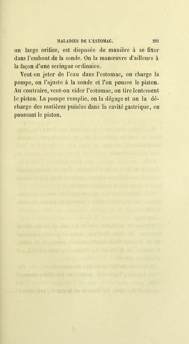 un large orifice, est disposée de manière à se fixer dans l’embout de la sonde. On la manœuvre d’ailleurs à la façon d’une seringue ordinaire. Veut-on jeter de l’eau dans l’estomac, on charge la pompe, on l’ajuste à la sonde et l’on pousse le piston. Au contraire, veut-on vider l’estomac, on tire lentement le piston. La pompe remplie, onia dégage et on la dé- charge des matières puisées dans la cavité gastrique, en poussant le piston.