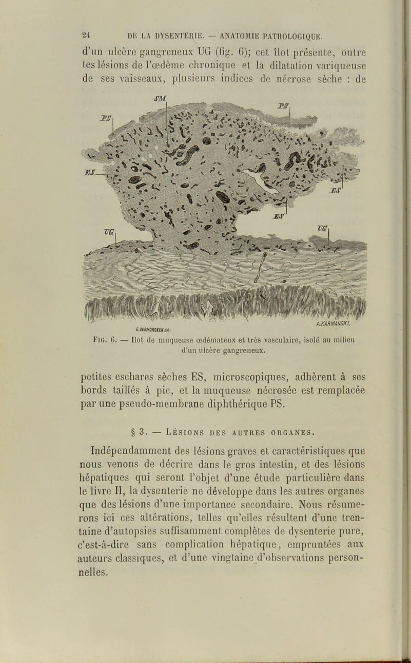 d’un ulcère gangreneux UG (fig. G); ccl îlot présente, outre (es lésions de l’œdème chronique et la dilatation variqueuse de ses vaisseaux, plusieurs indices de nécrose sèche : de e.vmoMUH.sc. Fig. 6. — Ilot de muqueuse œdémateux et très vasculaire, isolé au milieu d’un ulcère gangreneux. petites eschares sèches ES, microscopiques, adhèrent à ses bords taillés à pic, et la muqueuse nécrosée est remplacée par une pseudo-membrane diphthérique PS. § 3. — Lésions des autres organes. Indépendamment des lésions graves et caractéristiques que nous venons de décrire dans le gros intestin, et des lésions hépatiques qui seront l’objet d’une étude particulière dans le livre II, la dysenterie ne développe dans les autres organes que des lésions d’une importance secondaire. Nous résume- rons ici ces altérations, telles qu’elles résultent d’une tren- taine d’autopsies suffisamment complètes de dysenterie pure, c’est-à-dire sans complication hépatique, empruntées aux auteurs classiques, et d’une vingtaine d’observations person- nelles.