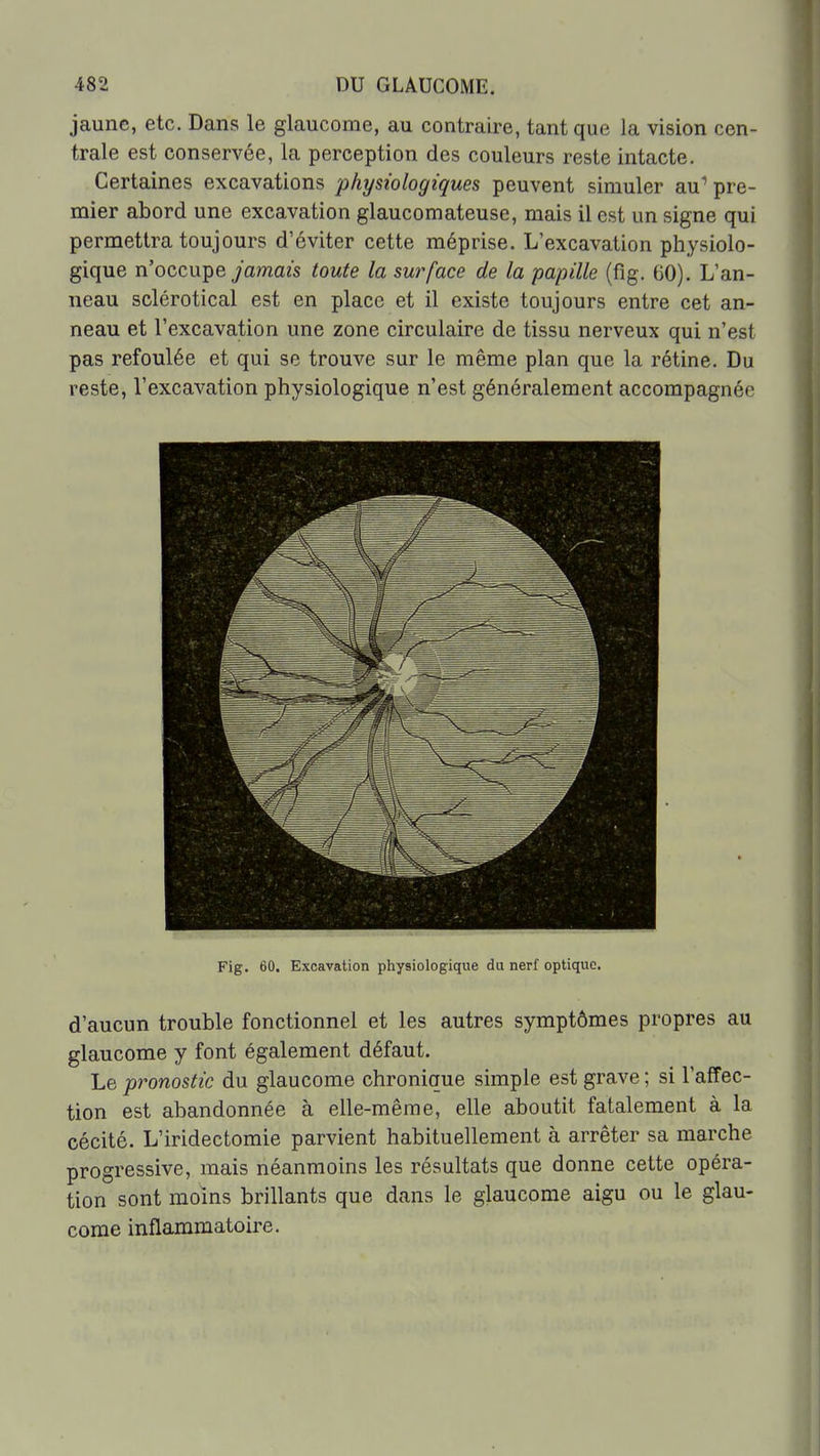jaune, etc. Dans le glaucome, au contraire, tant que la vision cen- trale est conservée, la perception des couleurs reste intacte. Certaines excavations physiologiques peuvent simuler au* pre- mier abord une excavation glaucomateuse, mais il est un signe qui permettra toujours d'éviter cette méprise. L'excavation physiolo- gique n'occupe yamazs toute la surface de la papille (fig. 60). L'an- neau sclérotical est en place et il existe toujours entre cet an- neau et l'excavation une zone circulaire de tissu nerveux qui n'est pas refoulée et qui se trouve sur le même plan que la rétine. Du reste, l'excavation physiologique n'est généralement accompagnée Fig. 60. Excavation physiologique du nerf optique. d'aucun trouble fonctionnel et les autres symptômes propres au glaucome y font également défaut. Le pronostic du glaucome chronique simple est grave ; si l'affec- tion est abandonnée à elle-même, elle aboutit fatalement à la cécité. L'iridectomie parvient habituellement à arrêter sa marche progressive, mais néanmoins les résultats que donne cette opéra- tion sont moins brillants que dans le glaucome aigu ou le glau- come inflammatoire.
