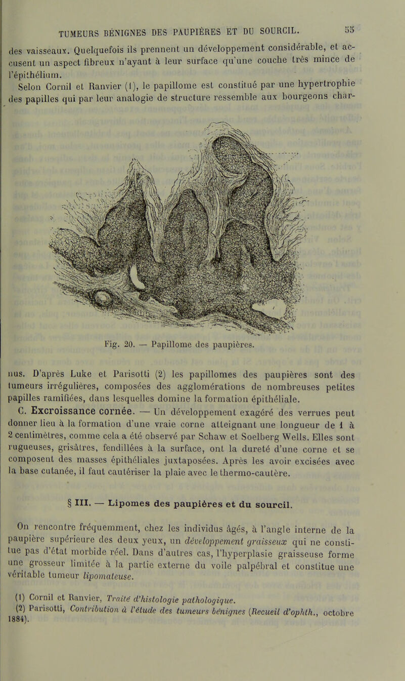 des vaisseaux. Quelquefois ils prennent un développement considérable, et ac- cusent un aspect fibreux n'ayant à leur surface qu'une couche très mince de l'épithélium. Selon Cornil et Ranvier (I), le papillome est constitué par une hypertrophie des papilles qui par leur analogie de structure ressemble aux bourgeons chàr- Fig. 20. — Papillome des paupières. nus. D'après Luke et Parisotti (2) les papillomes des paupières sont des tumeurs irrégulières, composées des agglomérations de nombreuses petites papilles ramifiées, dans lesquelles domine la formation épithéliale. C. Excroissance cornée. — Un développement exagéré des verrues peut donner lieu à la formation d'une vraie corne atteignant une longueur de 1 à 2 centimètres, comme cela a été observé par Schaw et Soelberg Wells. Elles sont rugueuses, grisàlres, fendillées à la surface, ont la dureté d'une corne et se composent des masses épithéliales juxtaposées. Après les avoir excisées avec la base cutanée, il faut cautériser la plaie avec le thermo-cautère. § in. — Lipomes des paupières et du sourcil. On rencontre fréquemment, chez les individus âgés, à l'angle interne de la paupière supérieure des deux yeux, un développement graisseux qui ne consti- tue pas d'état morbide réel. Dans d'autres cas, l'hyperplasie graisseuse forme une grosseur limitée à la partie externe du voile palpébral et constitue une véritable tumeur lipomateuse. (1) Cornil et Ranvier, Trait(f d'histologie pathologique. (2) Parisotti, Contribution à l'élude des tumeurs bénignes {Recueil d'ophlh., octobre