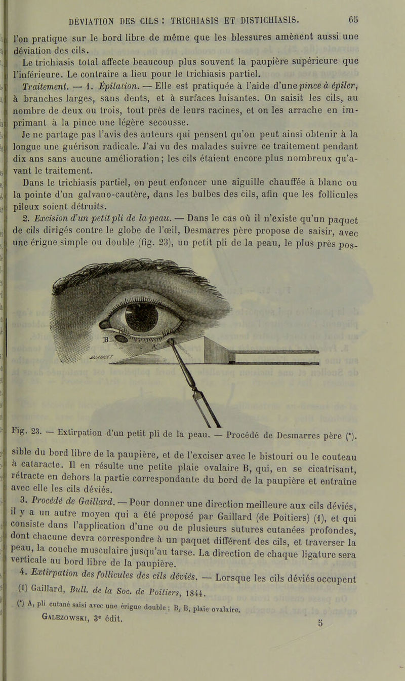 l'on pratique sur le bord libre de même que les blessures amènent aussi une déviation des cils. Le Irichiasis total affecte beaucoup plus souvent la paupière supérieure que l'inférieure. Le contraire a lieu pour le tricbiasis partiel. Traitement. — 1. Épilaiion. — Elle est pratiquée à l'aide d'une pmce à épiler, à branches larges, sans dents, et à surfaces luisantes. On saisit les cils, au nombre de deux ou trois, tout près de leurs racines, et on les arrache en im- primant à la pince une légère secousse. Je ne partage pas l'avis des auteurs qui pensent qu'on peut ainsi obtenir à la longue une guérison radicale. J'ai vu des malades suivre ce traitement pendant dix ans sans aucune amélioration ; les cils étaient encore plus nombreux qu'a- vant le traitement. Dans le Irichiasis partiel, on peut enfoncer une aiguille chauffée à blanc ou la pointe d'un galvano-cautère, dans les bulbes des cils, afin que les follicules pileux soient détruits. 2. Excision d'un petit pli de la peau. — Dans le cas où il n'existe qu'un paquet de cils dirigés contre le globe de l'œil. Desmarres père propose de saisir, avec une érigne simple ou double (fig. 23), un petit pli de la peau, le plus près pos- Fig. 23. — ExUrpalion d'un petit pli de la peau. — Procédé de Desmarres père (*). sible du bord libre de la paupière, et de l'exciser avec le bistouri ou le couteau a cataracte. Il en résulte une petite plaie ovalaire B, qui, en se cicatrisant, rétracte en dehors la partie correspondante du bord de la paupière et entraîne avec elle les cils déviés. 3. Procédé de Gaillard. - Pour donner une direction meilleure aux cils déviés Il y a un autre moyen qui a été proposé par Gaillard (de Poitiers) (1), et qui consiste dans l'application d'une ou de plusieurs sutures cutanées profondes, aont chacune devra correspondre à un paquet différent des cils, et traverser la peau, la couche musculaire jusqu'au tarse. La direction de chaque ligature sera verticale au bord libre de la paupière. 4. Extirpation des follicules des cils déviés. - Lorsque les cils déviés occupent (1) Gaillard, Bull, de la Soc. de Poitiers, 1844. n A, pli cutané saisi avec une érigne double ; B, B, plaie ovalaire. Galezowski, 3« édit. t.