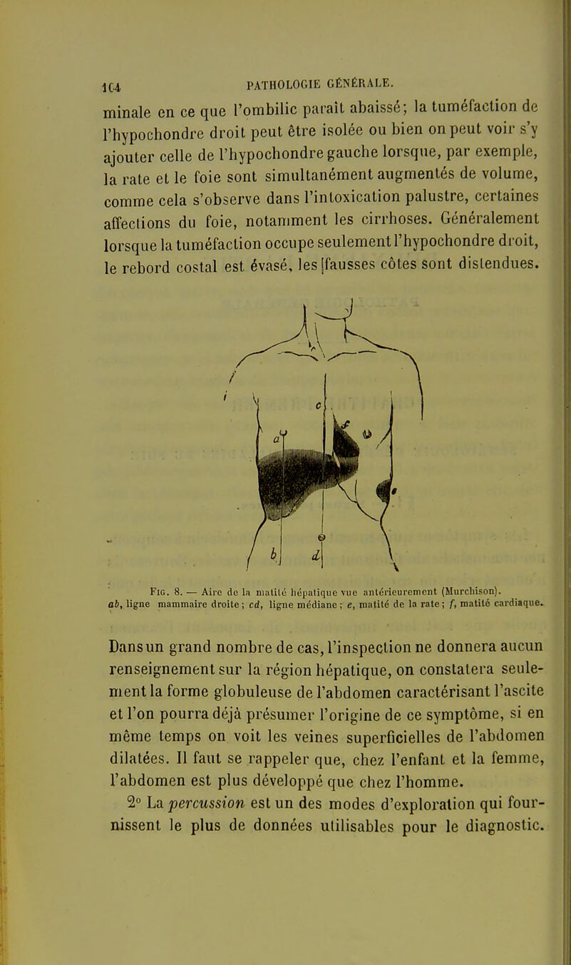 minale en ce que l'ombilic parait abaissé; la tuméfaction de l'hypochondre droit peut être isolée ou bien on peut voir s'y ajouter celle de l'hypochondre gauche lorsque, par exemple, la rate et le foie sont simultanément augmentés de volume, comme cela s'observe dans l'intoxication palustre, certaines affections du foie, notamment les cirrhoses. Généralement lorsque la tuméfaction occupe seulement l'hypochondre droit, le rebord costal est évasé, les [fausses côtes sont distendues. Fig. 8. — Aire de la matilé hépatique vue antérieurement (Murchison). ah, ligne mammaire droite; cd, ligne médiane; e, matité de la rate; f, matité cardiaque. Dansun grand nombre de cas, l'inspection ne donnera aucun renseignement sur la région hépatique, on constatera seule- ment la forme globuleuse de l'abdomen caractérisant l'ascite et l'on pourra déjà présumer l'origine de ce symptôme, si en même temps on voit les veines superficielles de l'abdomen dilatées. Il faut se rappeler que, chez l'enfant et la femme, l'abdomen est plus développé que chez l'homme. 2° La percussion est un des modes d'exploration qui four- nissent le plus de données utilisables pour le diagnostic.