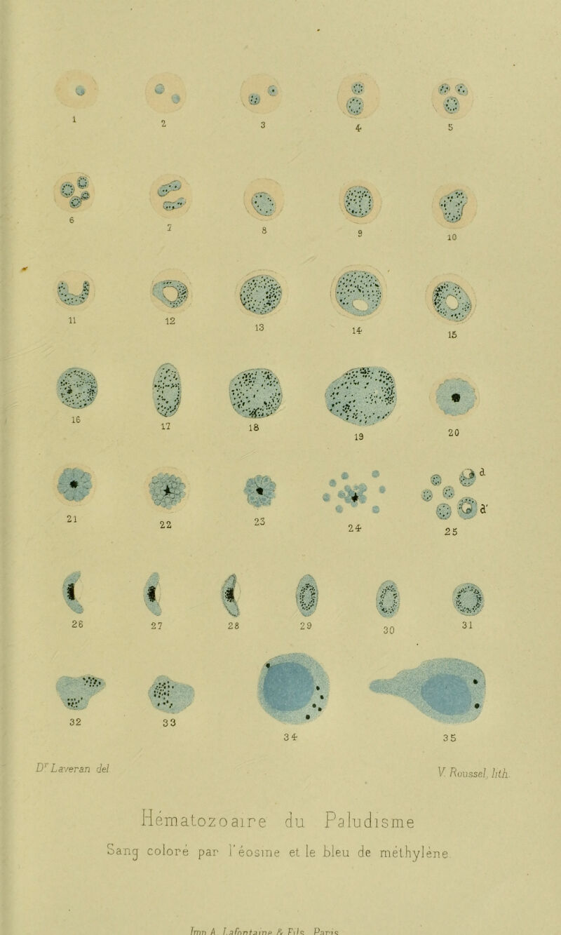 v.f (f;j 4 B .v 5 '•S»/ ir 6 v #4 •• •; 8 v. 4. . N*—£/•• «I • < Cf 10 r* a • •- 11 ( % 12 ..v ; ■ -.:P: 13 « « »,|, « • ^ *'• • • V 14- T?’' ♦v 15 , V. • *. 16 , # •. “• 7 17 ./.v.; -a: . • » ■ • * V't *#* % • ' y, .•-.•s: 18 '-J. •' ' * •• • ■ ■-V'.rfjC ♦ • * * 9 'fi * ' V'\;* * 19 ' ' « , 4*’ ' 4 20 ..i /•. # 21 f V«Y -••f * 22 - V 24- .ad | © a 25 i 26 27 ■■■ fi: V- 28 1 1 ! W U->- iîf $■: ♦« /« ->• V:;S, '.V/ 29 f ? •w .,*v •iCÇfV 31 ?î .fl- 32 : • • •V 33 34- ! l'i '- ’V ''-'..S » ■ ■: •• 35 Dp Laver an del V. Roussel, lith. Hématozoaire du Paludisme S an j coloré par l’éosme et le bleu de méthylène Jmn A I.afnntarnp K Fils Par-K