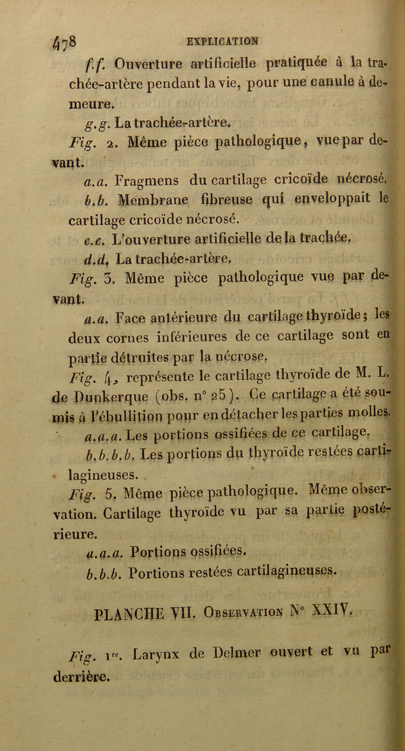 4;8 f. f. Ouverture artificielle pratiquée à la tra- chée-artère pendant la vie, pour une canule à de- meure. g. g. La trachéerartère. Fig. 2. Même pièce pathologique, vue par de- vant. a. a. Fragmens du cartilage cricoïde nécrosé. b. b. Membrane fibreuse qui enveloppait le cartilage cricoïde nécrosé. e. c. L'ouverture artificielle de la trachée. d.d. La trachée-artère. Fig. 3. Même pièce pathologique vue par de- vant. a. a. Face antérieure du cartilage thyroïde ; les deux cornes inférieures de ce cartilage sont en partie détruites par la nécrose. Fig. 4, représente le cartilage thyroïde de M. L. de Dunkerque (obs. n° 25). Ce cartilage a été sou- mis à l’ébullition pour en détacher les parties molles. a. a.a. Les portions ossifiées de ce cartilage. b. b. b.b. Les portions du thyroïde restées carti- • lagineuses. Fig. 5. Même pièce pathologique. Même obser- vation. Cartilage thyroïde vu par sa partie posté- rieure. a. a. a. Portions ossifiées. b. b.b. Portions restées cartilagineuses. PLANCHE YII. Observation N° XXIV. Fig. irc. Larynx de Delmer ouvert et vu par derrière.