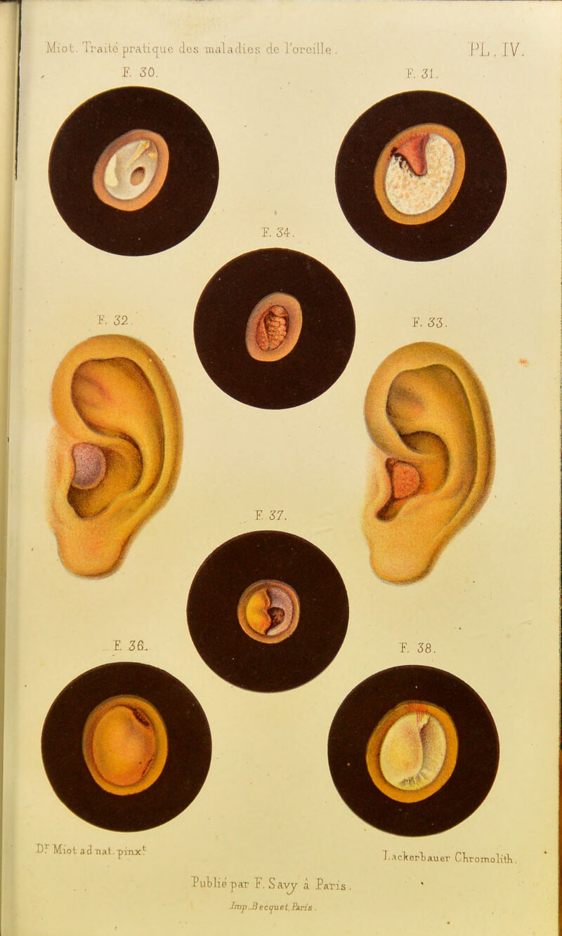 Publie par F. Savy à Paris fmp.Jjecc/ucl Paris .