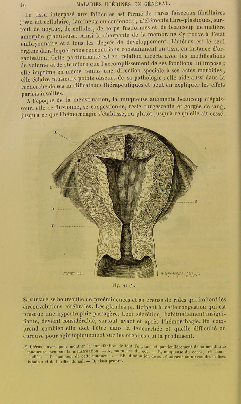 4 G Le tissu interpose aux follicules est formé de rares faisceaux fibrillaires (tissu dit cellulaire, lamineux ou conjonctif), d'éléments fibro-plasliques, sur- tout de noyaux, de cellules, de corps fusiformes et de beaucoup de matière amorphe granuleuse. Ainsi la charpente de la membrane s'y trouve à l'état embryonnaire et à tous les degrés de développement. L'utérus est le seul organe dans lequel nous rencontrions constamment un tissu en instance d'or- ganisation. Cette particularité est en relation directe avec les modifications de volume et de structure que l'accomplissement de ses fonctions lui impose ; elle imprime en môme temps une direction spéciale à ses actes morbides, elle éclaii'e plusieurs points obscurs de sa pathologie ; elle aide aussi dans la recherche de ses modificateurs thérapeutiques et peut en expliquer les effets parfois insolites. A l'époque de la menstruation, la muqueuse augmente beaucoup d'épais- seur, elle se fluxionne, se congestionne, reste turgescente et gorgée de sang, jusqu'à ce quel'hémorrhagie s'établisse, ou plutôt jusqu'à ce qu'elle ait cessé. Fig. 41 n. Sa surface se boursoufle de proéminences et se creuse de rides qui imitent les circonvolutions cérébrales. Les glandes participent à cette congestion qui est presque une hypertrophie passagère. Leur sécrétion, habituellement insigni- fiante, devient considérable, surtout avant et après l'hémorrhagie. On com- prend combien elle doit l'être dans la leucorrhée et quelle difficulté on éprouve pour agir topiquement sur les organes qui la produisent. (*) utérus ouvert pour moutrer la tumiSfaction de tout l'organe, nt particulièrement de sa menibranj muqueuse, pendant la nienstrnation. — A, muqueuse du col. — B, muqueuse du corps, très-bour- souflée. — C, épaisseur de cette muqueuse. — EF, diminution de son épaisseur au niveau des orifices tubaires et de l'orifice du col. — D, tissu propre.