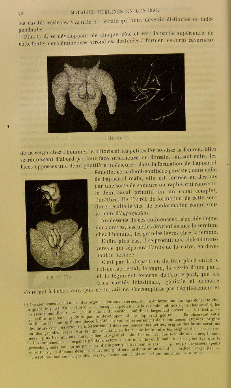 les cavités vésicale, vaginale et rectale qui vont devenir distinctes et indc- ^'pfrlard, se développent de chaque côté et vers la partie supérieure de cette rente, deuxéminences arrondies, destinées à former les corps caverneux Fig. 5/ {',. de la verge chez l'homme, le clitoris et les petites lèvres chez la femme. Klles se réunissent d'abord par leur face supérieure ou dorsale, laissant entre les laces opposées une demi-gouttière inférieure: dans la formation de 1 appareil femelle, cette demi-gouttière persiste ; dans celle de l'appareil màle, elle est fermée en dessous par une sorte de soudure ou raphé, qui convertit le demi-canal primitif en un canal complet, l'urèthre. De l'arrêt de formation de cette sou- dure résulte le Yice de conformation connu ?ous le nom d'hypospadia^. Au-dessous de ces éminencesil s'en développe deux autres, lesquelles devront former le scrotum ' chez l'homme, les grandes lèvres chez la femme, linfin, plus bas, il se produit une cloison trans- versale qui séparera l'anus de la vulve, en deve- nant le périnée. C'est par la disparition du tissu placé entre le cul-de-sac rectal, le vagin, la vessie d'une part, et le tégument externe de l'autre part, que les trois cavités intestinale, génitale et urinaire s'ouvrent à l'extérieur. Une ce travail ne s'accomplisse pas régulièrement et ,.v ,^ 1 n,.,«H,it de l auns el clos orL'aues gciniuiiix cxtf.ucs, sur un embryon humain, àg.i do lrenle-ciii.| (0 l)cvelo|3 KU^' de Urn^^ ^^ ,^ ^,^^i^„,„ o„,,.iUcalo ; do chaque colo. les a quarante 0 , <UlHç^l os ^ ^^^^^^^ i^^ ^^1^^^^ _ vaisseaux ^^^^^^^ ' , ,e d^veloppemenl de l'appareil génital. - En observant cette saillie '  ' ,,ilcée à coté, on voit supérieurement deux éminonces latérales, origme saillie de face ; 'i^f^rieure.ueiit doux é.ninencos plus petites, origine des futurs scrotums ,les futurs corps caveiii , ^^^^^^^ ^^^^^^ ^^^^^^ ^^..^-^^^ j„ corps caver- InTlms me ouverture, odlice uro-génital ; pins bas encore, une seconde ouverture l anus noux; plu. es génitaux externes, sur un embryon humain un peu plus âgé que le (••) Développement des O'b»^^ ^'^ distinguer positivement le sexe. - J>, corps caverneux (pénis préeédeut, niais dont ou e u 1^^,. , ,.„,iRce uro-génital. - :;Ï;^s 0::,;:r res). e„^re non r.unis sur la ligue moyeun. - a, anus. l'ig. 58 (•')