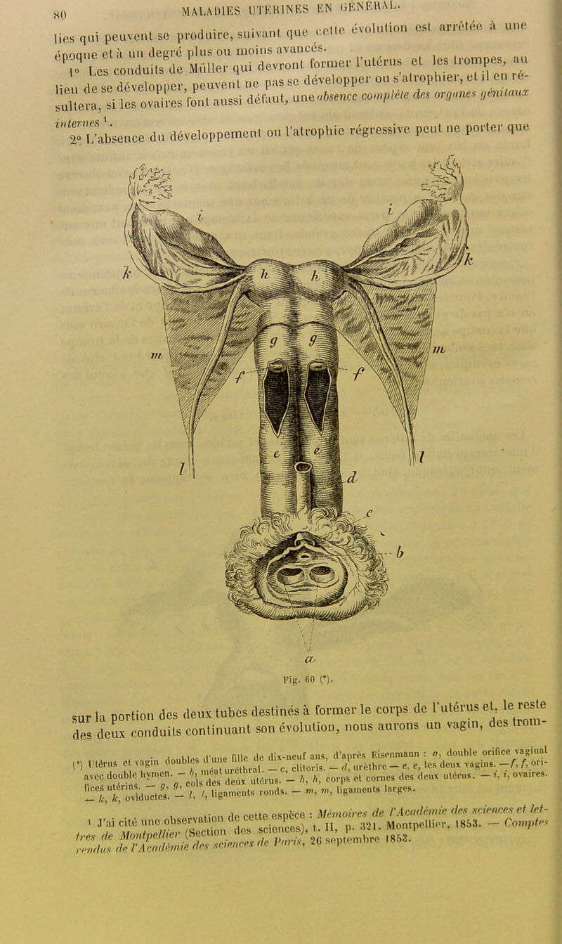 , • • „i „,^a l otip évolution esl arrêtée ;\ une lies qui peuvent se produire, suivant que tctie lvuiuuu énnnup et à un deerc plus ou moins avances. 'ÏTabsence du développcmen. on Vatiophic régressive peut ne porter ,ne a- Fig. 60 ('). sur la portion des deux tubes destinés à former le corps de Tutérus ej. le reste des deux conduits continuant son évolution, nous aurons un vagni, des trom ... 1- rn« A,, HU-nciif mis il'aurès Kispiimaiiu : a, douille orifice vaginal (•) ^Itéras çtva,in J^-^'f^^iî avec doub « y-- -, ' 'e^'utérus. - A, corps ot cornes des deux ulérus. - -, ovaires. , ,„tmn HP cette espèce : Mémoires de l'Académie des sciences et let- 1 J'ai cité une observation de cette espeoB i. MontpelliPiM 853. - Cow;)^^-