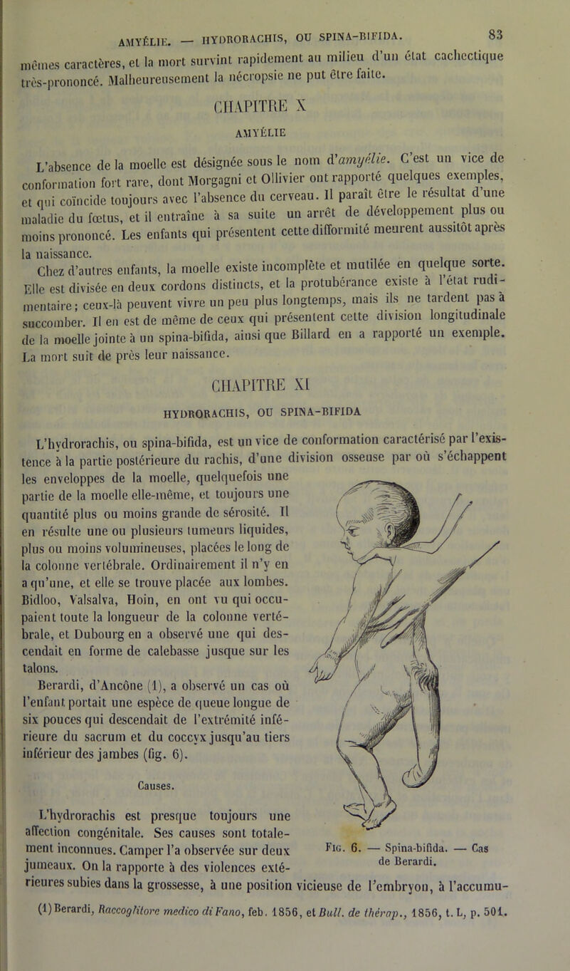 memes caractères, et la mort survint rapidement au milieu d’un état cachectique très-prononcé. Malheureusement la nécropsie ne put être faite. CHAPITRE X AMYÉLIE L’absence de la moelle est désignée sous le nom d’amyélie. C’est un vice de conformation fort rare, dont Morgagni et Ollivier ont rapporté quelques exemples, et qui coïncide toujours avec l’absence du cerveau. Il paraît être le résultat d une maladie du fœtus, et il entraîne à sa suite un arrêt de développement plus ou moins prononcé. Les enfants qui présentent cette difformité meurent aussitôt apres la naissance. , , Chez d’autres enfants, la moelle existe incomplète et mut.lee en quelque sor e. Elle est divisée en deux cordons distincts, et la protubérance existe a l’etat rudi- mentaire; ceux-là peuvent vivre un peu plus longtemps, mais ils ne tardent pas a succomber. Il en est de même de ceux qui présentent celte division longitudinale de la moelle jointe à un spina-bifida, ainsi que Billard en a rapporté un exemple. La mort suit de près leur naissance. CHAPITRE XI HYURORACHIS, OU SPINA-BIFIDA L’hvdrorachis, ou spina-bifida, est un vice de conformation caractérisé par l exis- tence à la partie postérieure du rachis, d’une division osseuse par où s échappent les enveloppes de la moelle, quelquefois une partie de la moelle elle-même, et toujours une quantité plus ou moins grande de sérosité. Il en résulte une ou plusieurs tumeurs liquides, plus ou moins volumineuses, placées le long de la colonne vertébrale. Ordinairement il n’y en a qu’une, et elle se trouve placée aux lombes. Bidloo, Valsalva, Hoin, en ont vu qui occu- paient toute la longueur de la colonne verté- brale, et Dubourg en a observé une qui des- cendait en forme de calebasse jusque sur les talons. Berardi, d’Ancône (1), a observé un cas où l’enfant portait une espèce de queue longue de six pouces qui descendait de l’extrémité infé- rieure du sacrum et du coccyx jusqu’au tiers inférieur des jambes (fig. 6). Causes. L’hvdrorachis est presque toujours une affection congénitale. Ses causes sont totale- ment inconnues. Camper l’a observée sur deux jumeaux. On la rapporte à des violences exté- rieures subies dans la grossesse, à une position vicieuse de l’embryon, à l’accumu- Fig. 6. - Spina-bifida. — Cas de Berardi. (1)Berardi, RaccogHtorc medico cliFano, feb. 1856, et Bull, de thèrap., 1856, t. L, p. 501.