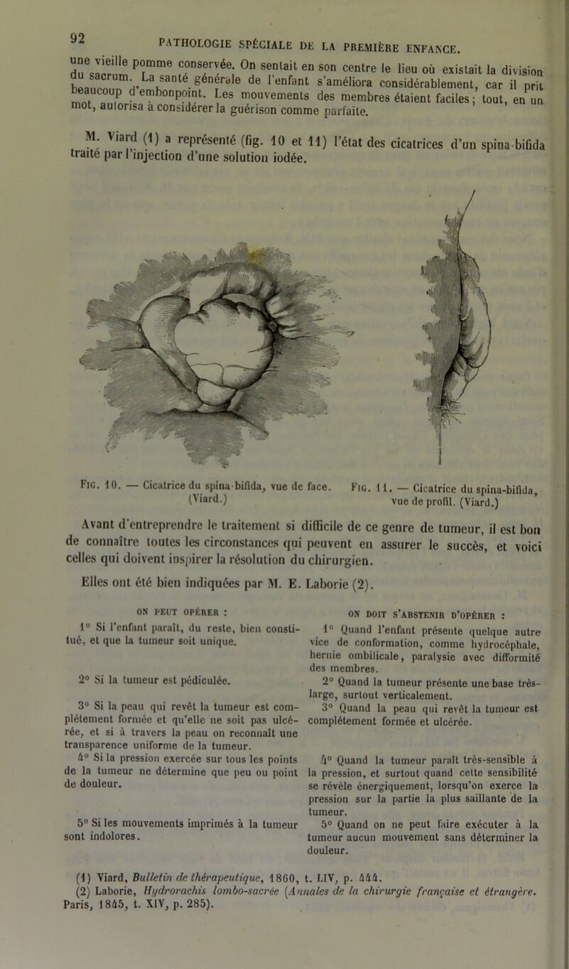 rji!!!le Prme COnsf'!ée- 0n senlait en s°n centre le lieu où existait la division beaucounmdVLahanté 6 de renfant s’améliora considérablement, car il prit mot d b0nP°] ^6S mouvements des membres étaient faciles; tout, en un mot, autorisa a considérer la guérison comme parfaite. M. Yiard (1) a représenté (fig. 10 et 11) l’état des cicatrices d’un spina-bifida traite par 1 injection d’une solution iodée. Fie. 10. — Cicatrice du spina-bifida, vue de face. Fig. 11. — Cicatrice du spina-bifida, (\iard.) vue de profil. (Viard.) Avant d’entreprendre le traitement si difficile de ce genre de tumeur, il est bon de connaître toutes les circonstances qui peuvent en assurer le succès, et voici celles qui doivent inspirer la résolution du chirurgien. Elles ont été bien indiquées par M. E. Laborie (2). OS PEUT OPÉRER : 1° Si l’enfant parait, du reste, bien consti- tué, et que la tumeur soit unique. 2° Si la tumeur est pédiculée. 3° Si la peau qui revêt la tumeur est com- plètement formée et qu’elle ne soit pas ulcé- rée, et si à travers la peau on reconnaît une transparence uniforme de la tumeur. 4° Si la pression exercée sur tous les points de la tumeur ne détermine que peu ou point de douleur. 5° Si les mouvements imprimés à la tumeur sont indolores. os doit s’abstenir d’opérer : 1° Quand l’enfant présente quelque autre vice de conformation, comme hydrocéphale, hernie ombilicale, paralysie avec difformité des membres. 2° Quand la tumeur présente une base très- large, surtout verticalement. 3° Quand la peau qui revêt la tumeur est complètement formée et ulcérée. A0 Quand la tumeur paraît très-sensible à la pression, et surtout quand celte sensibilité se révèle énergiquement, lorsqu’on exerce la pression sur la partie la plus saillante de la tumeur. 5° Quand on ne peut faire exécuter à la tumeur aucun mouvement sans déterminer la douleur. (1) Viard, Bulletin de thérapeutique, 1860, t. LIV, p. 444. (2) Laborie, Hi/drorachis lombo-sacrée (Annales de la chirurqie française et étrangère. Paris, 1845, t. XIV, p. 285).