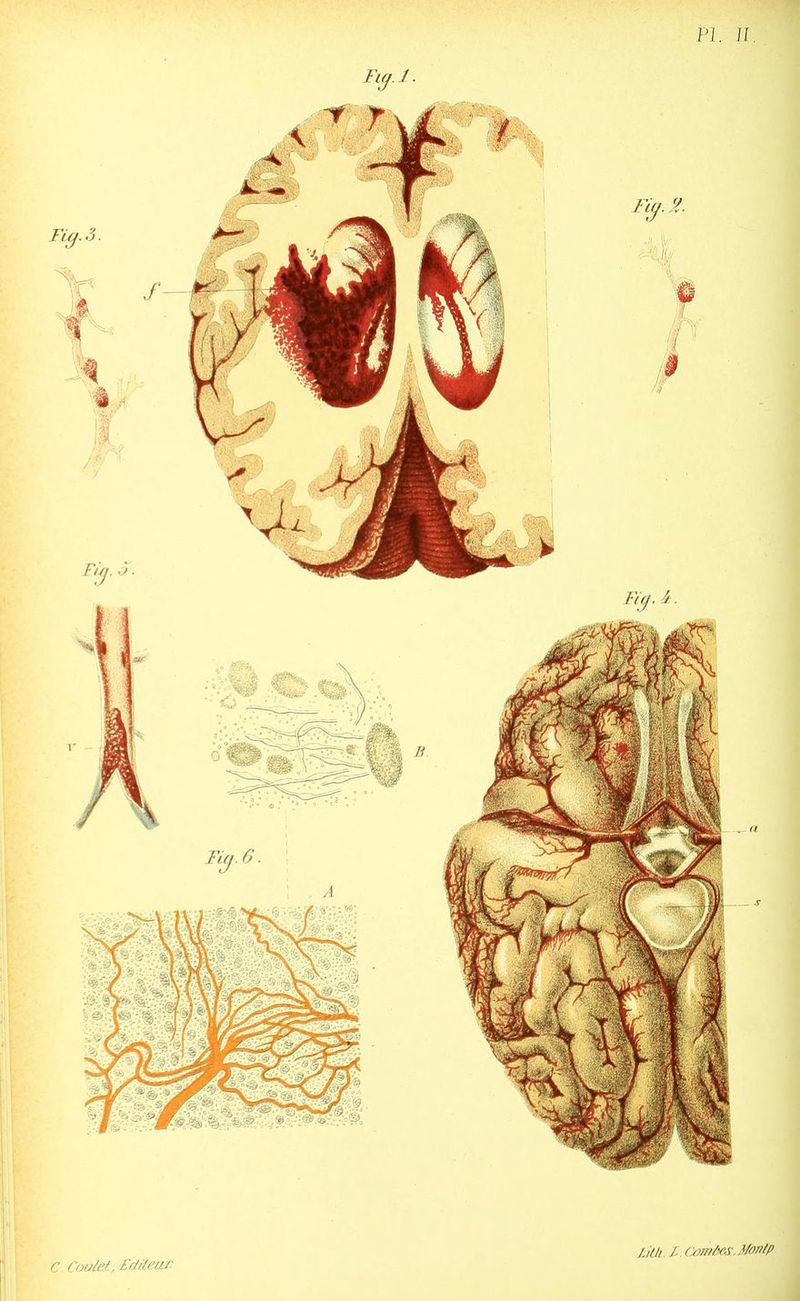Pl. JI r Coalet, Eddeur. Lilli. l. cornùes.Monfp