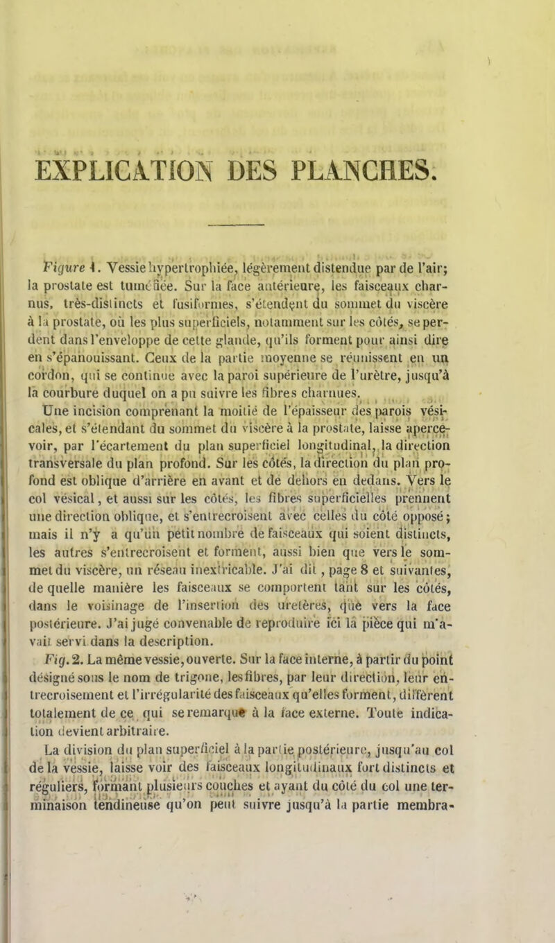 EXPLICATION DES PLANCHES. Figure \. Vessie hypertrophiée, légèrement distendue par de l'air; la prostate est tuméfiée. Sur la face antérieure, les faisceaux char- nus, très-distincts et fusifornîes, s'étendent du sommet du viscère à la prostate, où les plus superficiels, notamment sur les côtés, se per- dent dans l'enveloppe de celte glande, qu'ils forment pour ainsi dire en s'épanouissant. Ceux de la partie moyenne se réunissent en un cordon, qui se continue avec la paroi supérieure de l'urètre, jusqu'à la courbure duquel on a pu suivre les fibres charnues. Une incision comprenant la moitié de l'épaisseur des |>arois vési- cales, et s'élendant du sommet du viscère à la prostate, laisse aperce- voir, par l'écartement tlu plan superficiel longitudinal, la direction transversale du plan profond. Sur les côtés, la direction du plan pro- fond est oblique d'arrière en avant et de dehors en dedans. Vers le col vésical, et aussi sur les côtés, les fibres superficielles prennent une direction oblique, et s'entrecroisent avec celles du côté opposé; mais il n'y a qu'un petit nombre de faisceaux qui soient distincts, les autres s'entrecroisent et forment, aussi bien que vers le som- met du viscère, un réseau inextricable. J'ai dit, page 8 et suivantes, de quelle manière les faisceaux se comportent tant sur les côtés, dans le voisinage de l'insertion des uretères, que vers la face postérieure. J'ai jugé convenable de reproduire ici la pièce qui m'a- vait servi dans la description. F/g. 2. La même vessie, ouverte. Sur la face interne, à partir du point désigné sous le nom de trigone, les fibres, par leur direction, leur en- trecroisement et l'irrégularité des faisceaux qu'elles forment, diffèrent totalement de ce qui se remarqué à la iace externe. Toute indica- tion devient arbitraire. La division du plan superficiel à la par lie postérieure, jusqu'au col delà vessie, laisse voir des faisceaux longitudinaux fort distincts et réguliers, formant plusieurs couches et ayant du côté du col une ter- minaison tendineuse qu'on peut suivre jusqu'à la partie membra-