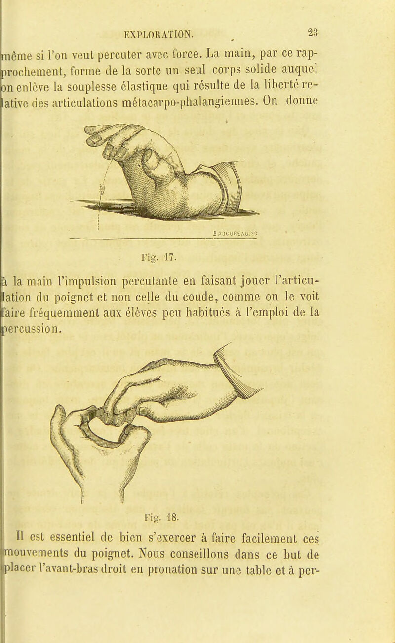 même si l'on veut percuter avec force. La main, par ce rap- prochement, forme de la sorte un seul corps solide auquel m enlève la souplesse élastique qui résulte de la liberté re- ative des articulations mélacarpo-phalangiennes. On donne B AOOUHEMJ.SC Fig. 17. à la main l'impulsion percutante en faisant jouer l'articu- lation du poignet et non celle du coude, comme on le voit faire fréquemment aux élèves peu habitués à l'emploi de la percussion. Fig. 18. Il est essentiel de bien s'exercer à faire facilement ces mouvements du poignet. Nous conseillons dans ce but de Iplacer l'avant-bras droit en pronation sur une table et à per-