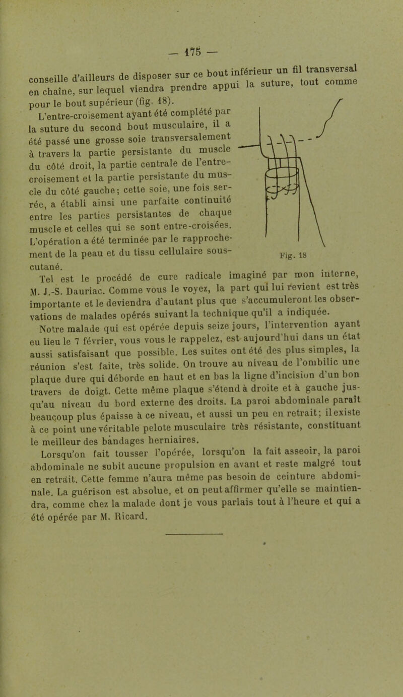 Kmit inférieur un fil transversal conseille d'ailleurs de disposer sur ce bout miên eu chaîne, sur lequel viendra prendre appui la suture, pour le bout supérieur (fig, 18). L’entre-croisement ayant été complété par la suture du second bout musculaire, il a été passé une grosse soie transversalement à travers la partie persistante du muscle du côté droit, la partie centrale de l’entre- croisement et la partie persistante du mus- cle du côté gauche; cette soie, une fois ser- rée, a établi ainsi une parfaite continuité entre les parties persistantes de chaque muscle et celles qui se sont entre-croisées. L’opération a été terminée par le rapproche- ment de la peau et du tissu cellulaire sous- cutané. Tel est le procédé de cure radicale imaginé par mon interne, M. J -S. Dauriac. Comme vous le voyez, la part qui lui revient est très importante et le deviendra d’autant plus que s’accumuleront les obser- vations de malades opérés suivant la technique qu’il a indiquée. Notre malade qui est opérée depuis seize jours, l’intervention ayant eu lieu le 1 février, vous vous le rappelez, est aujourd’hui dans un état aussi satisfaisant que possible. Les suites ont été des plus simples, la réunion s’est faite, très solide. On trouve au niveau de l’ombilic une plaque dure qui déborde en haut et en bas la ligne d’incision d’un bon travers de doigt. Cette même plaque s’étend à droite et à gauche jus- qu’au niveau du bord externe des droits. La paroi abdominale paraît beaucoup plus épaisse à ce niveau, et aussi un peu en retrait, il existe à ce point une véritable pelote musculaire très résistante, constituant le meilleur des bandages herniaires. Lorsqu’on fait tousser l’opérée, lorsqu’on la fait asseoir, la paroi abdominale ne subit aucune propulsion en avant et reste malgré tout en retrait. Cette femme n’aura même pas besoin de ceinture abdomi- nale. La guérison est absolue, et on peut affirmer qu’elle se maintien- dra, comme chez la malade dont je vous parlais tout à 1 heure et qui a été opérée par M. Ricard.