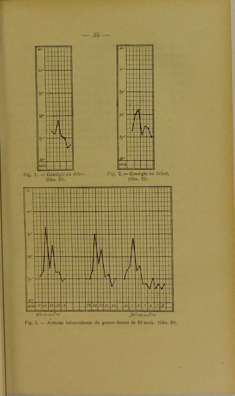 Fig. 1. — Coxalgie au début. Fig. 2. — Coxalgie au début. (Obs. 23). (Obs. 22).
