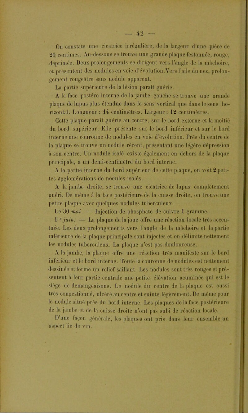 On constale une cicatrice irrégulière, de la largeur d’une pièce de 20 centimes. Au-dessous se trouve une grande plaque festonnée, rouge, déprimée. Deux prolongements se dirigent vers l’angle de la mâchoire, et présentent des nodules en voie d’évolution.Vers l’aile du nez, prolon- gement rougeâtre sans nodule apparent. La partie supérieure de la lésion paraît guérie. A la face postéro-interne de la jambe gauche se trouve uue grande plaque de lupus plus étendue dans le sens vertical que dans le sens ho- rizontal. Longueur: 14 centimètres. Largeur: 12 centimètres. Celle plaque parait guérie au centre, sur le bord externe et la moitié du bord supérieur. Elle présente sur le bord inférieur et sur le bord interne une couronne de nodules en voie d’évolution. Près du centre de la plaque se trouve un nodule récent, présentant une légère dépression à son centre. Un nodule isolé existe également en dehors de la plaque principale, à un demi-centimètre du bord interne. A la partie interne du bord supérieur de celte plaque, on voit 2 peti- tes agglomérations de nodules isolés. A la jambe droite, se trouve une cicatrice de lupus complètement guéri. De même à la face postérieure de la cuisse droite, on trouve une petite plaque avec quelques nodules tuberculeux. Le 30 mai. — Injection de phosphate de cuivre 1 gramme. 1er juin. — La plaque de la joue oll're une réaction locale très accen- tuée. Les deux prolongements vers l’angle de la mâchoire et la partie inférieure de la plaque principale sont injectés et on délimite nettement les nodules tuberculeux. La plaque n’est pas douloureuse. A la jambe, la plaque offre une réaction très manifeste sur le bord inférieur et le bord interne. Toute la couronne de nodules est nettement dessinée et forme un relief saillant. Les nodules sont très rouges et pré- sentent à leur partie centrale une petite élévation acuminée qui est le siège de démangeaisons. Le nodule du centre de la plaque est aussi très congestionné, ulcéré au centre et suinte légèrement. De même pour le nodule situé près du bord interne. Les plaques de la face postérieure de la jambe et de la cuisse droite n’ont pas subi de réaction locale. D une façon générale, les plaques ont pris dans leur ensemble un aspect lie de vin.