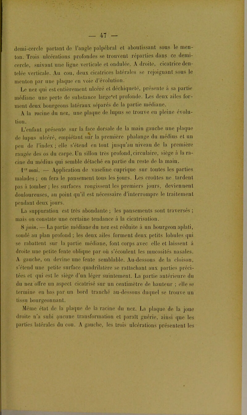 demi-cercle partant de l’angle palpébral et aboutissant sous le men- ton. Trois ulcérations profondes se trouvent réparties dans ce demi- cercle, suivant une ligne verticale et ondulée. A droite, cicatrice den- telée verticale. Au cou, deux cicatrices latérales se rejoignant sous le menton par une plaque en voie d’évolution. Le nez qui est entièrement ulcéré et déchiqueté, présente à sa partie médiane une perte de substance large'et profonde. Les deux ailes lor- ment deux bourgeons latéraux séparés de la partie médiane. A la racine du nez, une plaque de lupus se trouve en pleine évolu- tion. L’enfant présente sur la face dorsale de la main gauche une plaque de lupus ulcéré, empiétant sur la première phalange du médius et un peu de l’index ; elle s’étend en tout jusqu’au niveau de la première rangée des os du carpe. Un sillon très profond, circulaire, siège à la ra- cine du médius qui semble détaché en partie du reste de la main. 1er mai. — Application de vaseline cuprique sur toutes les parties malades ; on fera le pansement tous les jours. Les croûtes ne tardent pas à tomber ; les surfaces rougissent les premiers jours, deviennent douloureuses, au point qu’il est nécessaire d’interrompre le traitement pendant deux jours. La suppuration est très abondante ; les pansements sont traversés ; mais on constate une certaine tendance à la cicatrisation. 8 juin. — La partie médiane du nez est réduite à un bourgeon aplati, soudé au plan profond ; les deux ailes forment deux petits lobules qui se rabattent sur la partie médiane, font corps avec elle et laissent à droite une petite feule oblique par où s’écoulent les mucosités nasales. A gauche, on devine une fente semblable. Au-dessous de la cloison, s’étend une petite surface quadrilatère se rattachant aux parties préci- tées et qui est le siège d’un léger suintement. La partie antérieure du du nez offre un aspect cicatrisé sur un centimètre de hauteur ; elle se termine en bas par un bord tranché au-dessous duquel se trouve un tissu bourgeonnant. Même état de la plaque de la racine du nez. La plaque de la joue droite n’a subi çucune transformation et paraît guérie, ainsi que les parties latérales du cou. A gauche, les trois ulcérations présentent les