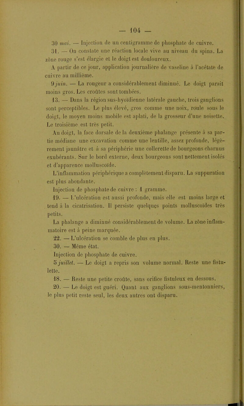 30 mai. — Injection de un centigramme de phosphate de cuivre. 31. — On constate une réaction locale vive au niveau du spina. La zone rouge s’est élargie et le doigt est douloureux. A partir de ce jour, application journalière de vaseline à l’acétate de cuivre au millième. 9 juin. — La rougeur a considérablement diminué. Le doigt parait moins gros. Les croûtes sont tombées. 13. — Dans la région sus-hyoïdienne latérale gauche, trois ganglions sont perceptibles. Le plus élevé, gros comme une noix, roule sous le doigt, le moyen moins mobile est aplati, de la grosseur d’une noisette. Le troisième est très petit. Au doigt, la face dorsale delà deuxième phalange présente à sa par- tie médiane une excavation comme une lentille, assez profonde, légè- rement jaunâtre et à sa périphérie une collerette de bourgeons charnus exubérants. Sur le bord externe, deux bourgeons sont nettement isolés et d’apparence molluscoïde. L’inflammation périphérique a complètement disparu. La suppuration est plus abondante. Injection de phosphate de cuivre : 1 gramme. 19. — L’ulcération est aussi profonde, mais elle est moins large et tend à la cicatrisation. Il persiste quelques points molluscoïdes très petits. La phalange a diminué considérablement de volume. La zone inflam- matoire est à peine marquée. 22. —L’ulcération se comble de plus en plus. 30. — Même état. Injection de phosphate de cuivre. 5 juillet. — Le doigt a repris son volume normal. Reste une fistu- lette. 18. — Reste une petite croûte, sans orifice fistnleux en dessous. 20. — Le doigt est guéri. Quant aux ganglions sous-mentonniers, le plus petit reste seul, les deux autres ont disparu.
