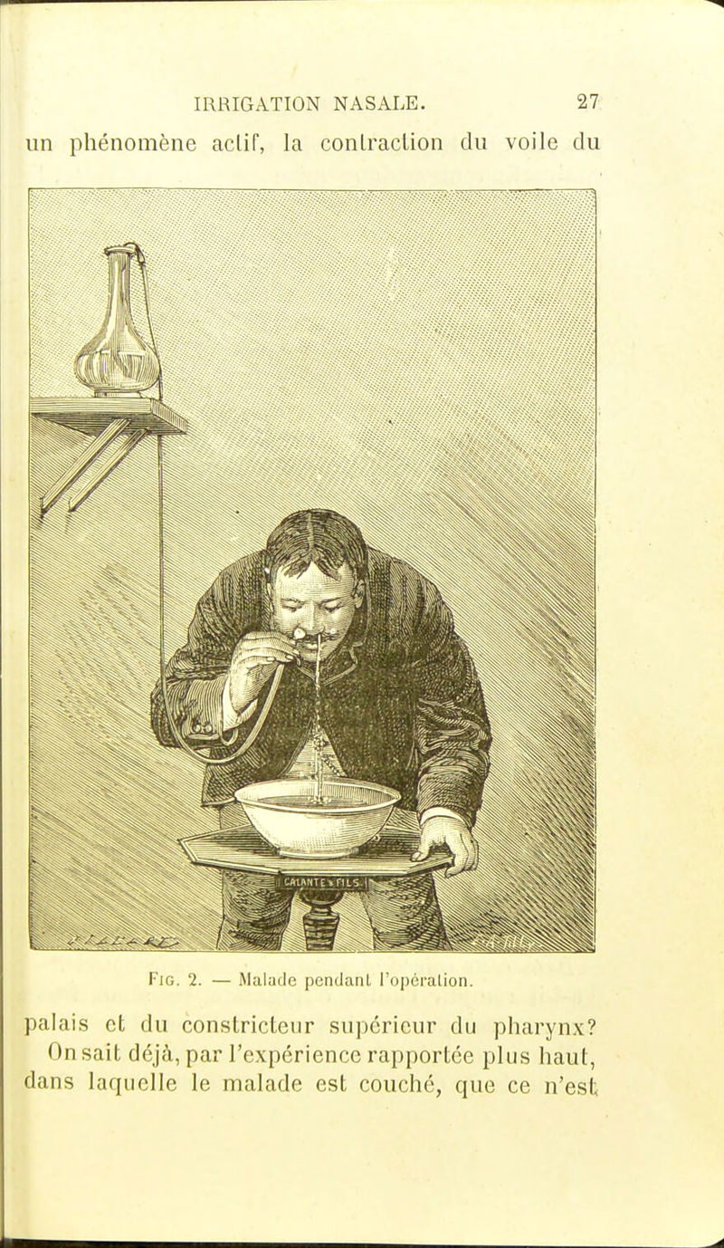 un phénomène actif, la contraction du voile du Fig. 2. — Malade pendanl l'opéraLion. palais et du constricteur supérieur du pharynx? On sait déjà, par l'expérience rapportée plus haut, dans laquelle le malade est couché, que ce n'est