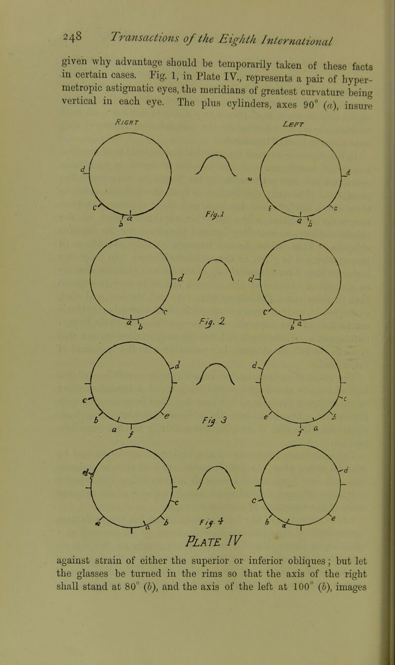 given why advantage should be temporarily taken of these facts in certain cases. Fig. 1, in Plate IV, represents a pair of hyper- metropic astigmatic eyes, the meridians of greatest curvature being vertical in each eye. The plus cylinders, axes 90° (a), insure Right Lept Plate IV against strain of either the superior or inferior obliques; but let the glasses be turned in the rims so that the axis of the right shall stand at 80° (&), and the axis of the left at 100° (J), images