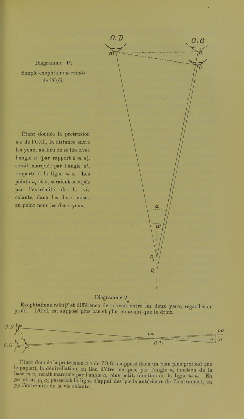 0.2? o.c Diagranune 1°. Simple exopMalmus relatif cle I'O.G. Etant donn^e la protrusion ?i 0 de rO.G., la distance entre las yeux, au lieu de se lire avec I'angle a (par rapport k m serait marquee par Tangle a^, rapporte a la ligne m o. Les points et Oj seraient oocupes par Vextremit^ de la vis calante, dans les deux mises au point pour les deux yeux. Diagramme 2 . Exophtalmus relatif et difif^rence de niveau entre les deux yeux, regard^s en profil. L'O.G. est suppose plus bas et plus en avant que le droit. Etant donnee la protrusion n o de I'O.G. (suppos(i dans un plan plus profoud que le papier), la denivellation, au lieu d'etre marquee par Tangle a, fonctiou de la base m n, serait marqude par Tangle a, plus petit, fonction de la ligne m n. En pa et en passerait la ligne d'appui des pieds anterieurs de Tinstrument, en J)p lextromitu do la vis calante.