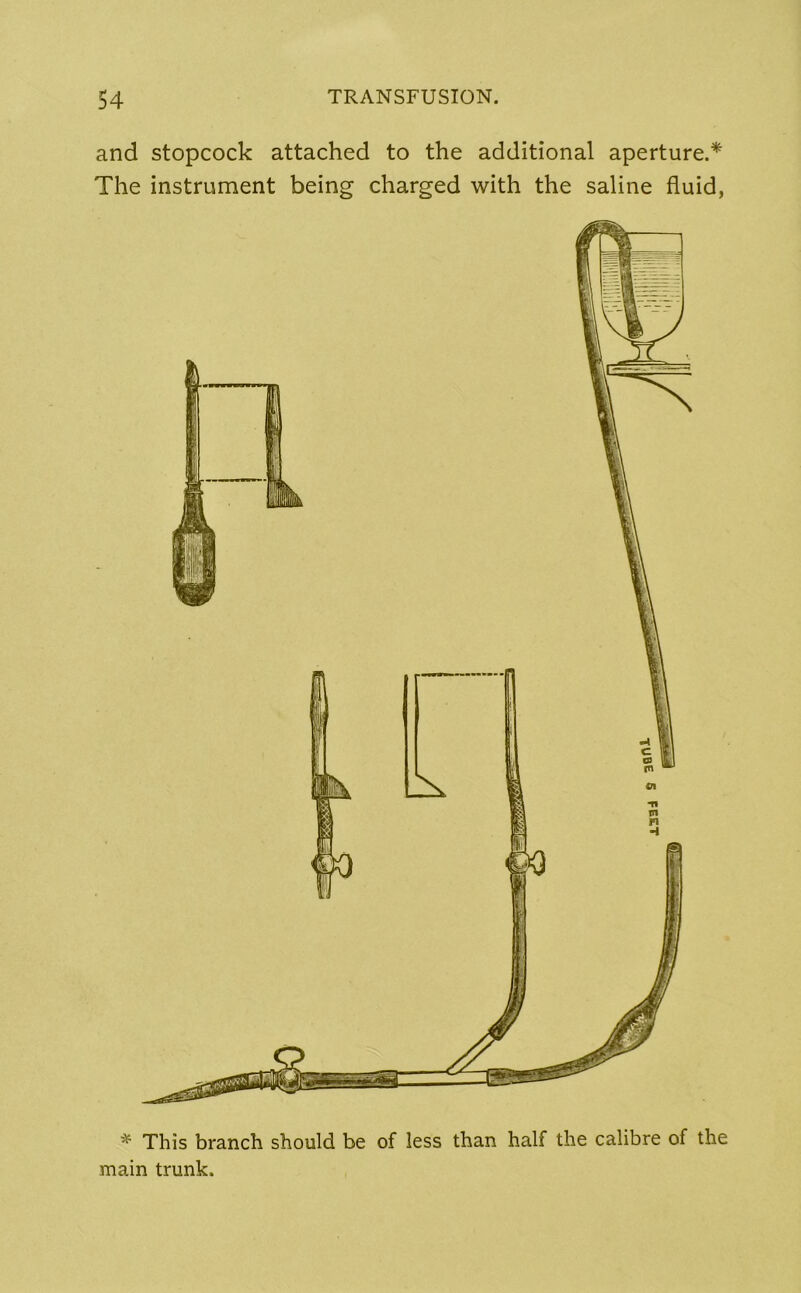 and stopcock attached to the additional aperture.* The instrument being charged with the saline fluid, * This branch should be of less than half the calibre of the main trunk.