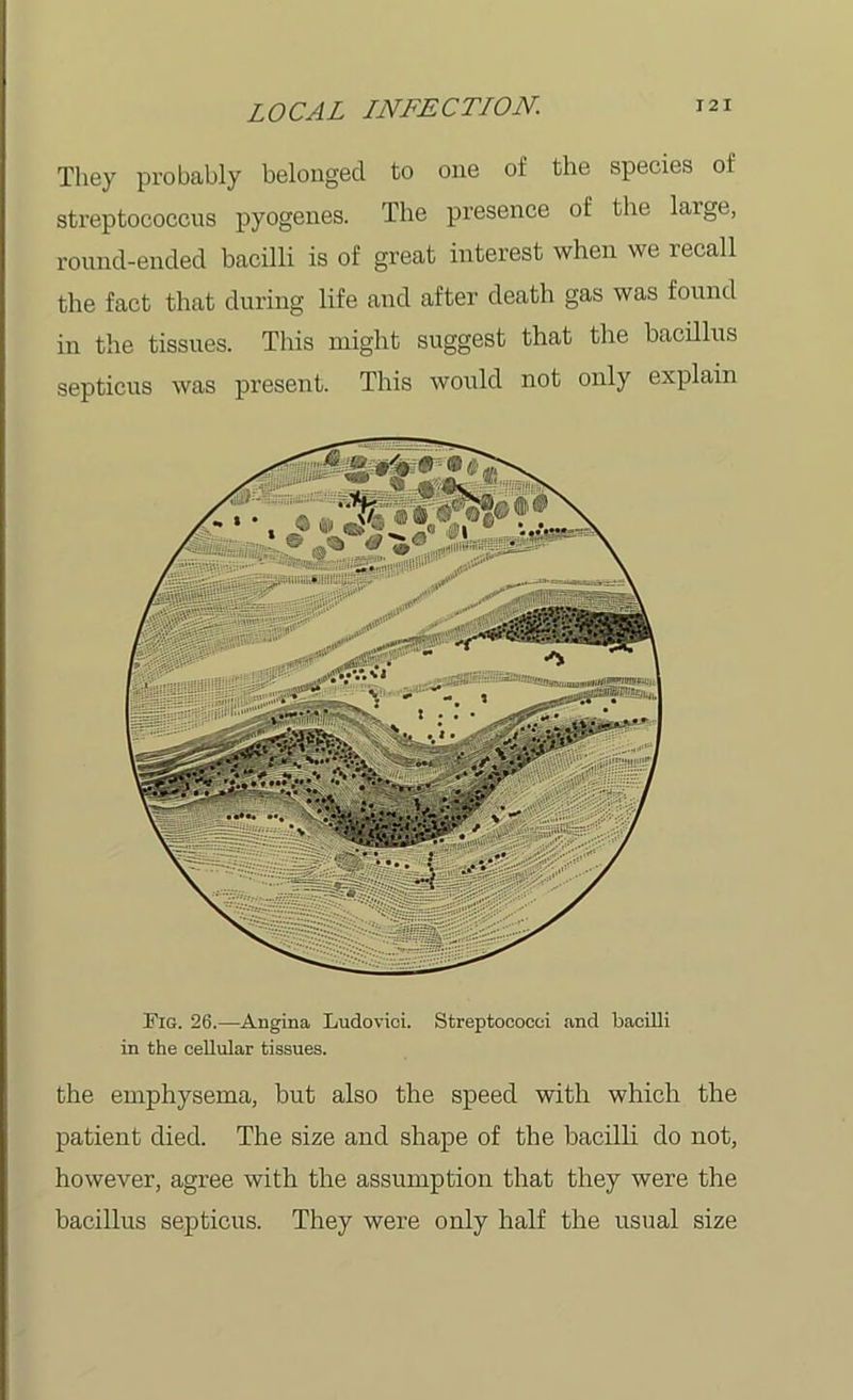 They probably belonged to one of the species of streptococcus pyogenes. The presence of the large, round-ended bacilli is of great interest when we recall the fact that during life and after death gas was found in the tissues. This might suggest that the bacillus septicus was present. This would not only explain Fig. 26.—Angina Ludovici. Streptococci and bacilli in the cellular tissues. the emphysema, but also the speed with which the patient died. The size and shape of the bacilli do not, however, agree with the assumption that they were the bacillus septicus. They were only half the usual size