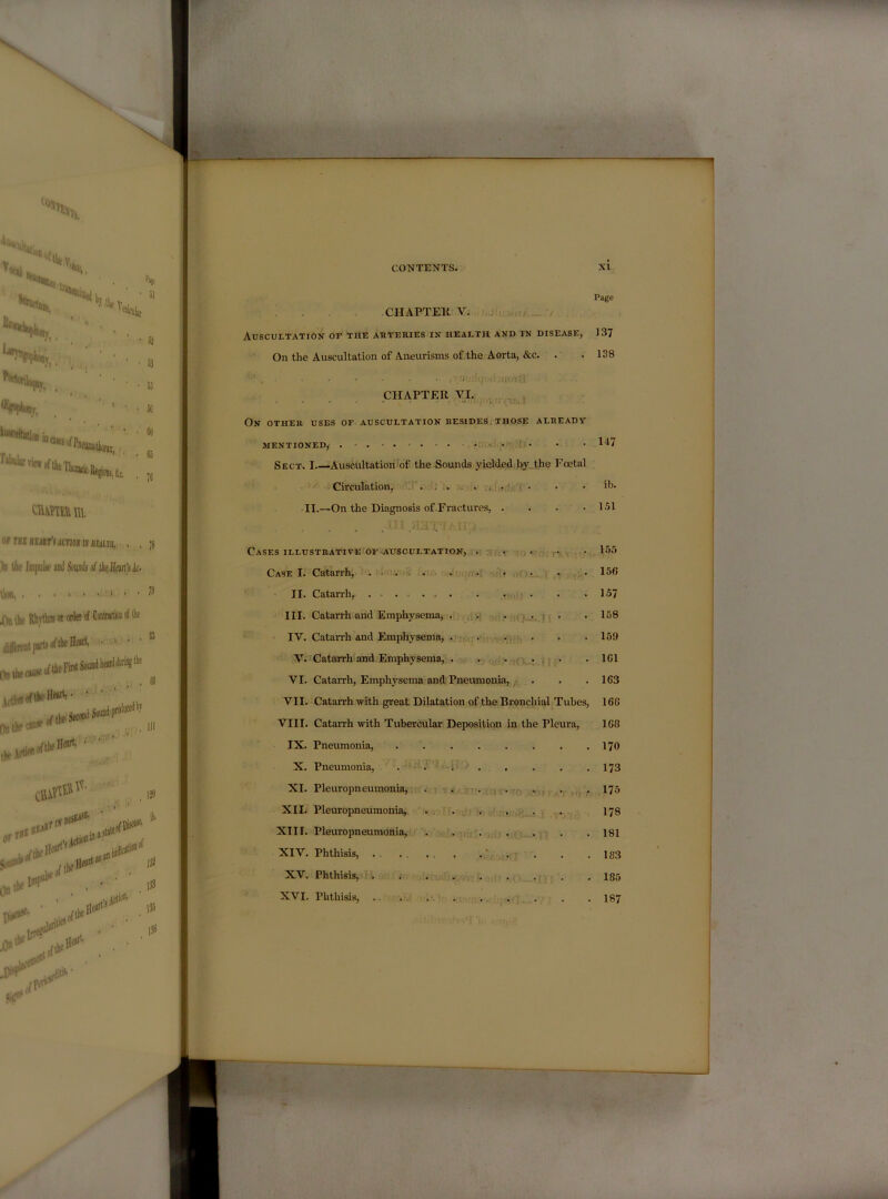 Page CHAPTEll V. j! . / Auscultation of the auteries in health and in disease, On the Auscultation of Aneurisms of.the Aorta, &c. . 137 138 CHAPTER VI. On other uses of auscultation besides;those already MENTIONED, . ■ • Sect. I Auscultation of the Sounds yielded hy.the Foetal Circulation, . . ; . ; • II.—On the Diagnosis of .Fractures, . 147 ib. 151 Cases illustrative OF ^auscultation, . .. . . . 155 Case I. Catarrh, . . ;. ,if i- • • 156 II. Catan-h, ....... . . . .157 III. Catarrh and Emphysema, . ,, >[ . -i; . . 158 IV. Catarrh and Emphysema, .. . • . , . . . 159 V. Catarrh and Emphysema, . . . .161 VI. Catarrh, Emphysema and Pneumonia,/V . . .163 VII. Catarrh with great Dilatation of the Bronchial Tubes, 166 VIII. Catarrh with Tubercular Deposition in the Pleura, 168 IX. Pneumonia, 170 X. Pneumonia, . . . . , . . .173 XI. Pleuropneumonia, . . . . <j.,. . , , 175 XII. Pleuropneumonia, . . . ... . 178 XIII. Pleuropneumonia, I8I XIV. Phthisis, . . . . . . . . . . . 183 XV. Phthisis, , . . . , . . . . 185 XVI. Phthisis, . . , I87