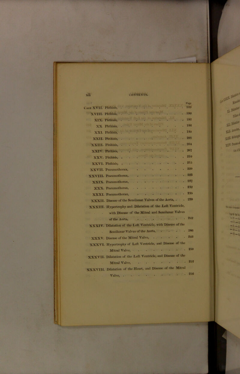 mtm i XU CONTENTS. Case XVII. XVIII. XIX. XX XXI. XXII. XXIII. XXIV. XXV. XXVI. XXVII. XXVIII. XXIX. XXX. XXXI. XXXII. XXXIII. XXXIV. XXXV. XXXVI. XXXVII. XXXVIII. Phthisis, Phthisis, Phthisis, Phthisis, Phthisis, Phthisis, Phthisis, Phthisis, Phthisis,- Phthisis, , Pneumothorax, Pneumothorax, Pneumothorax, Pneumothorax, Pneumothorax, Disease of the Semilunar Valves of the Aorta, Hypertrophy and Dilatation of the Left Ventricle, with Disease of the Mitral and Semilunar Valves of the Aorta, Dilatation of the Left Ventricle, with Disease of the Semilunar Valves of the Aort-a, .... Disease of the Mitral Valve, Hypertrophy of Left Ventricle, and Disease of the Mitral Valve, Dilatation of the Left Ventricle, and Disease of the Mitral Valve, . Dilatation of the Heart, and Disease of the Mitral Valve, . Page IfW 190 192 19G 19.9 201 204 207 210 215 220 223 227 232 235 239 242 2iG 248 250 252 256